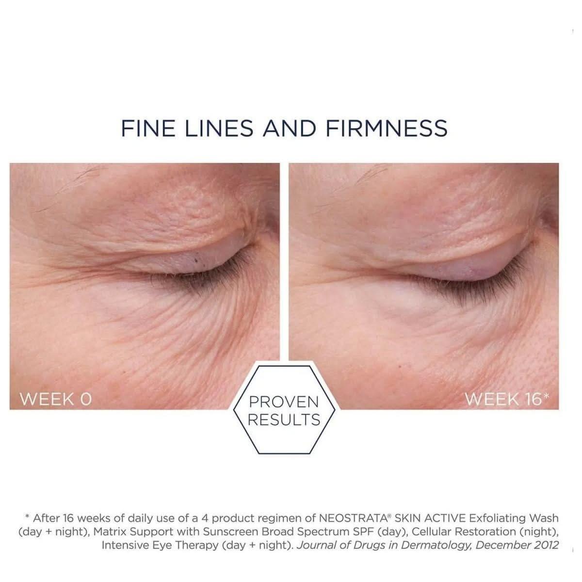 Neostrata Cellular Restoration – 50ml | Anti-Ageing Treatment with 15% AHA/PHA Blend for Skin Renewal Neostrata Cellular Restoration - 50ml - Glam Global UKNeostrata