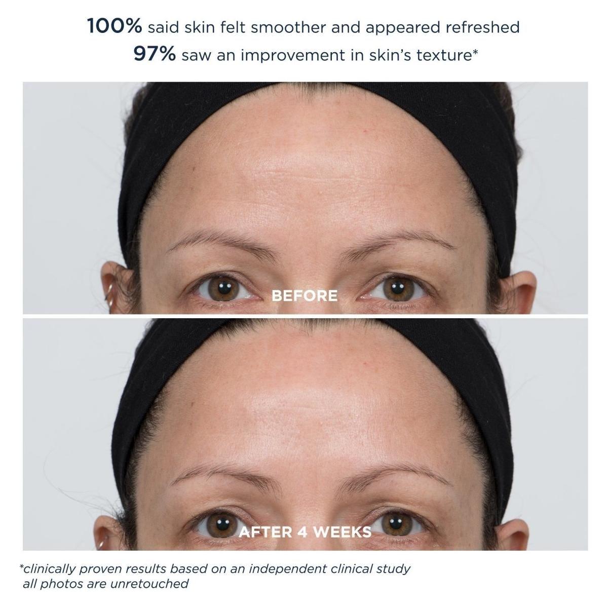 M-61 PowerGlow Peel Extra Strength 20% – 20 Treatments | Pro-Strength Glycolic Acid Resurfacing Pads M - 61 PowerGlow Peel Extra Strength 20% - 20 Treatments - Glam Global UKM - 61