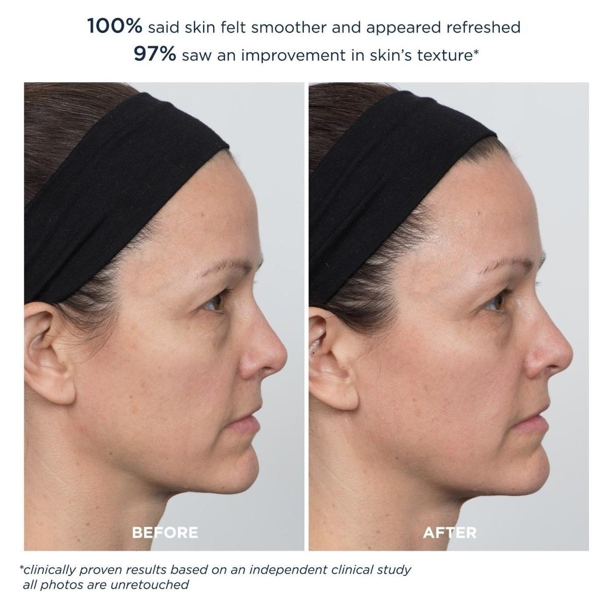 M-61 PowerGlow Peel Extra Strength 20% – 20 Treatments | Pro-Strength Glycolic Acid Resurfacing Pads M - 61 PowerGlow Peel Extra Strength 20% - 20 Treatments - Glam Global UKM - 61