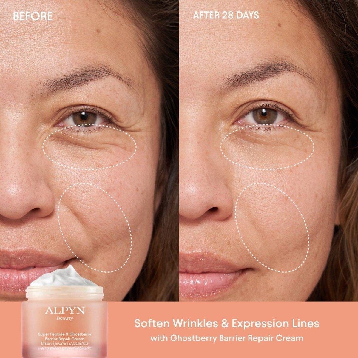 Alpyn Beauty Super Peptide & Ghostberry Barrier Repair Cream – 50ml | Deep Hydration & Wrinkle-Relaxing Moisturiser Alpyn Beauty Super Peptide and Ghostberry Barrier Repair Cream - 50ml - Glam Global UKAlpyn Beauty