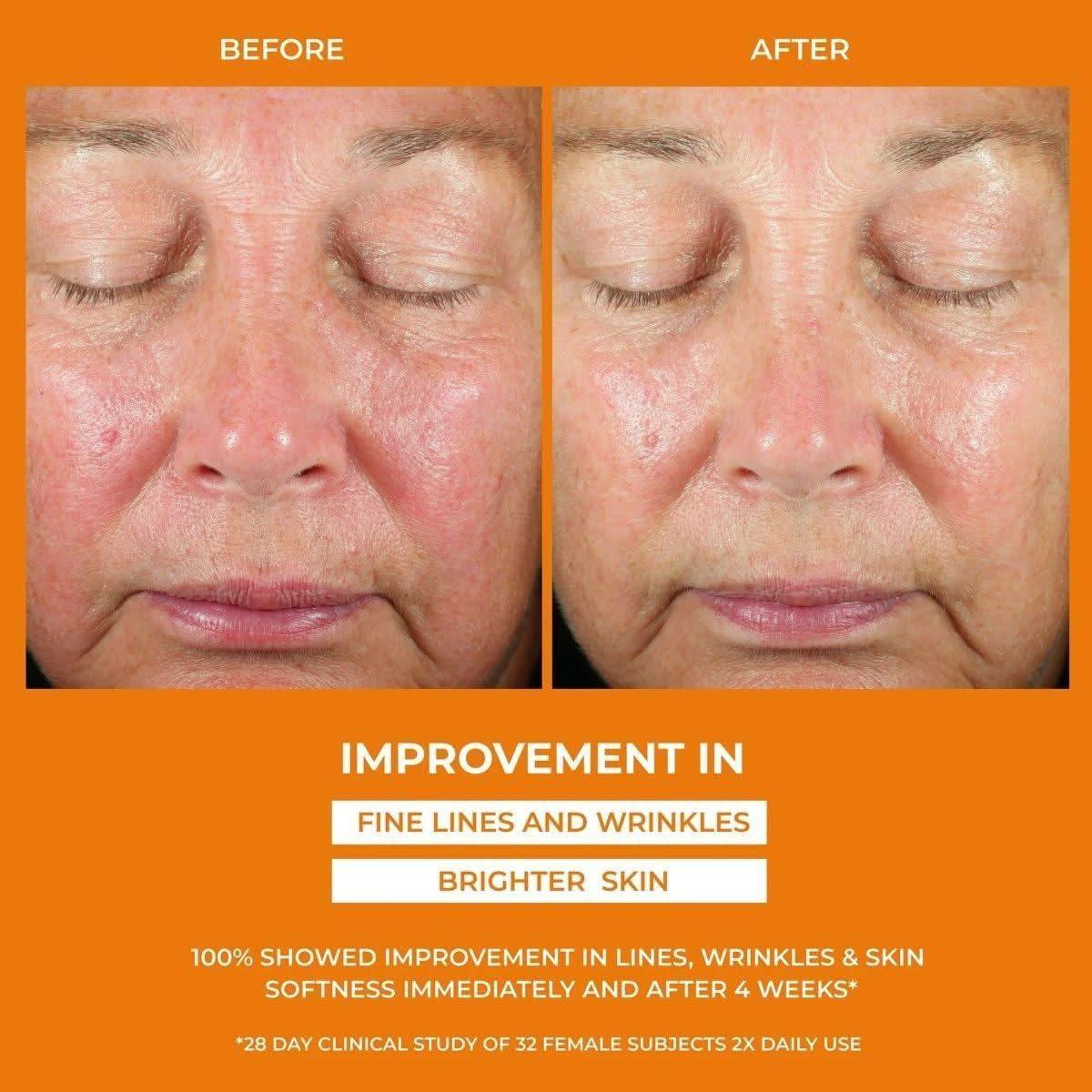 BeautyStat Universal C Skin Refiner Vitamin C Serum + SPF 50 Mineral Sunscreen – 30ml | Brightening & Anti-Aging UV Protection BeautyStat Universal C Skin Refiner Vitamin C Serum + SPF 50 Mineral Sunscreen - 30ml - Glam Global UKBeautyStat