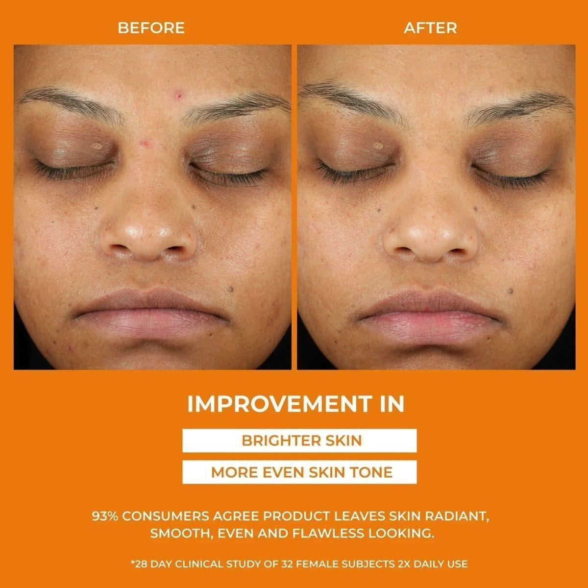 BeautyStat Universal C Skin Refiner Vitamin C Serum + SPF 50 Mineral Sunscreen – 30ml | Brightening & Anti-Aging UV Protection BeautyStat Universal C Skin Refiner Vitamin C Serum + SPF 50 Mineral Sunscreen - 30ml - Glam Global UKBeautyStat