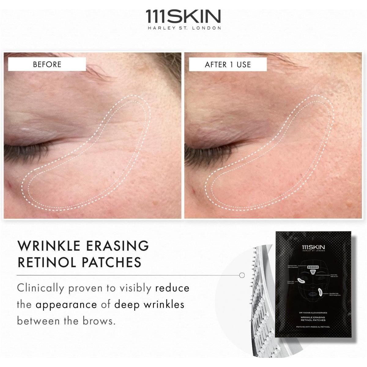 111SKIN Wrinkle Erasing Retinol Patches (Pack of 3) | Targeted Fine Line & Wrinkle Treatment 111SKIN Wrinkle Erasing Retinol Patches | Targeted Fine Line & Wrinkle Treatment (Pack of 3) - Glam Global UK111SKIN