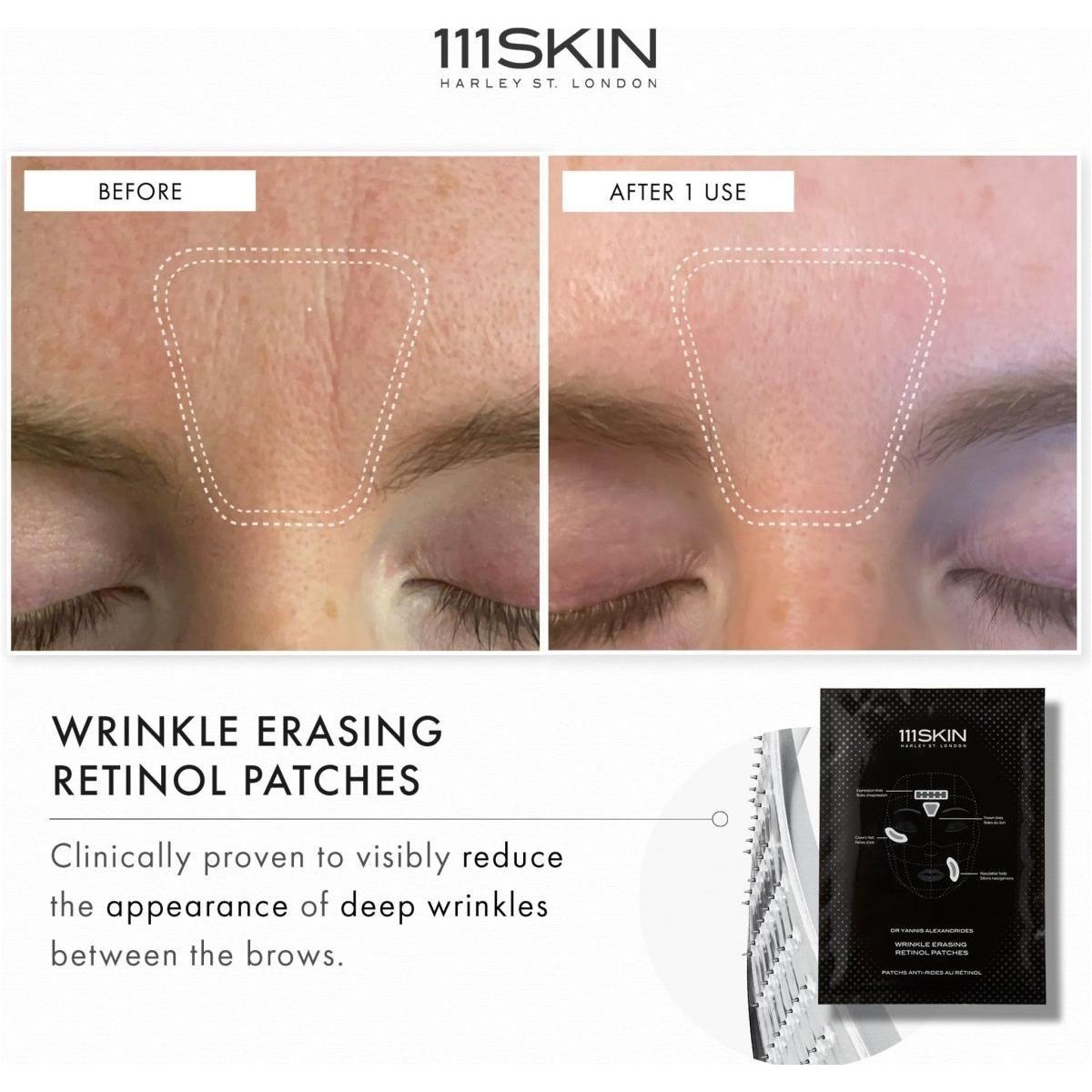 111SKIN Wrinkle Erasing Retinol Patches (Pack of 3) | Targeted Fine Line & Wrinkle Treatment 111SKIN Wrinkle Erasing Retinol Patches | Targeted Fine Line & Wrinkle Treatment (Pack of 3) - Glam Global UK111SKIN