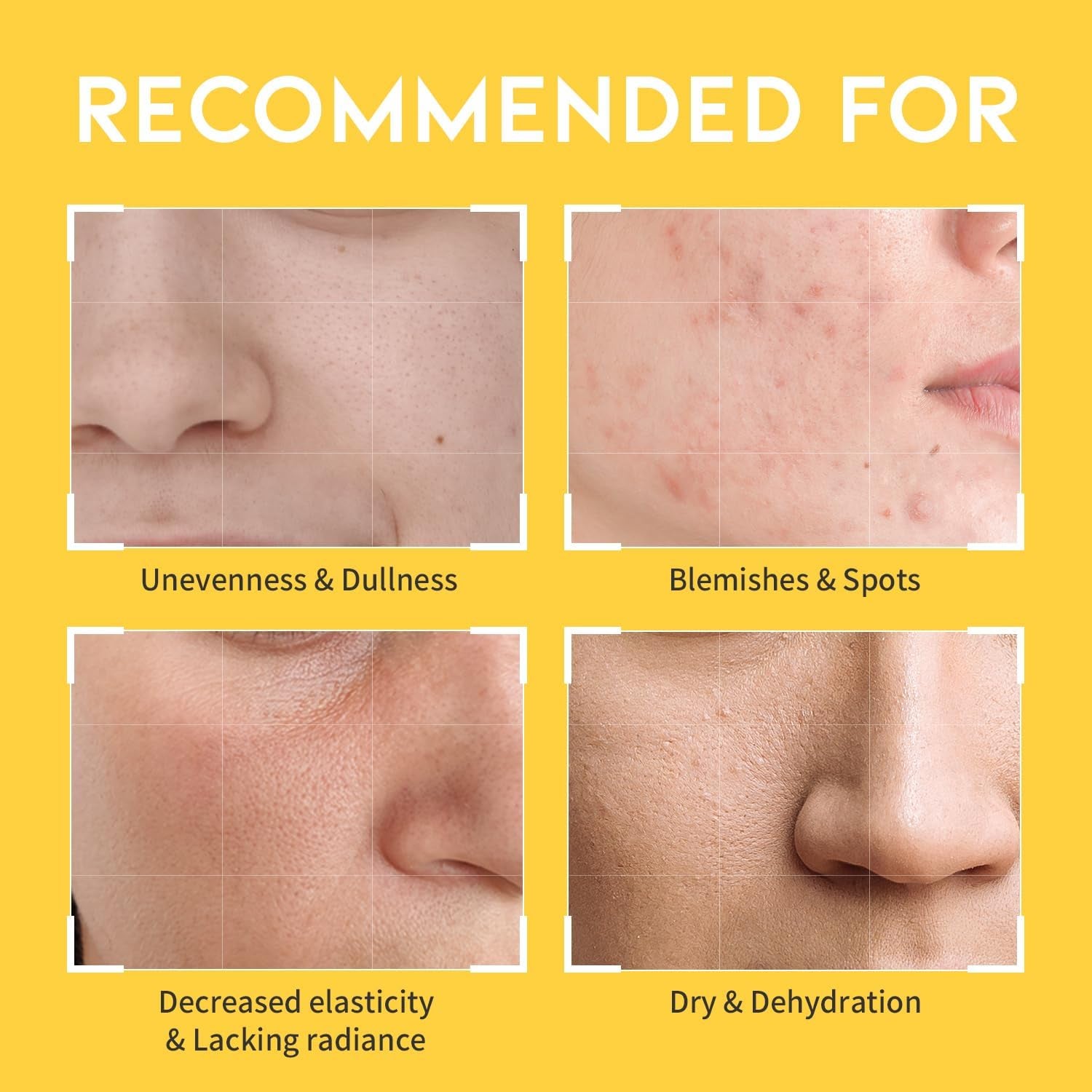 #OOTD VC+ Dark Spot Vitamin C Toner - 250ml