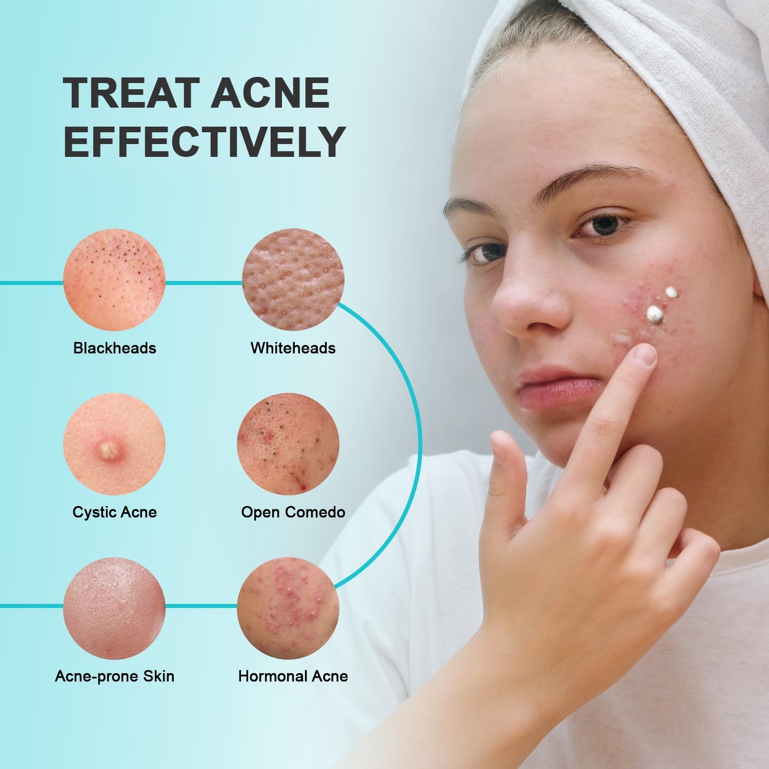 Enaskin Naturals 10% Azelaic Acid Acne Treatment – 50g | Advanced Acne & Scar Defense Gel-Cream