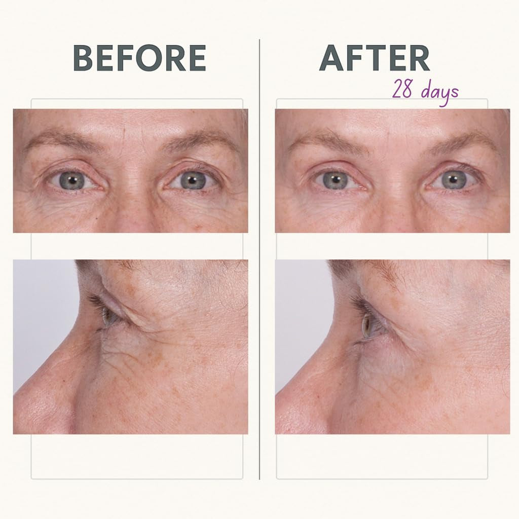 Reverse Lift Tightening Eye Cream with Peptides, Hydrating Anti-Aging, Temporarily Lift Eyelids, Eyebrow, under Eye Skin Firming Wrinkle Formula, Women, Men,1 Fl. Oz.