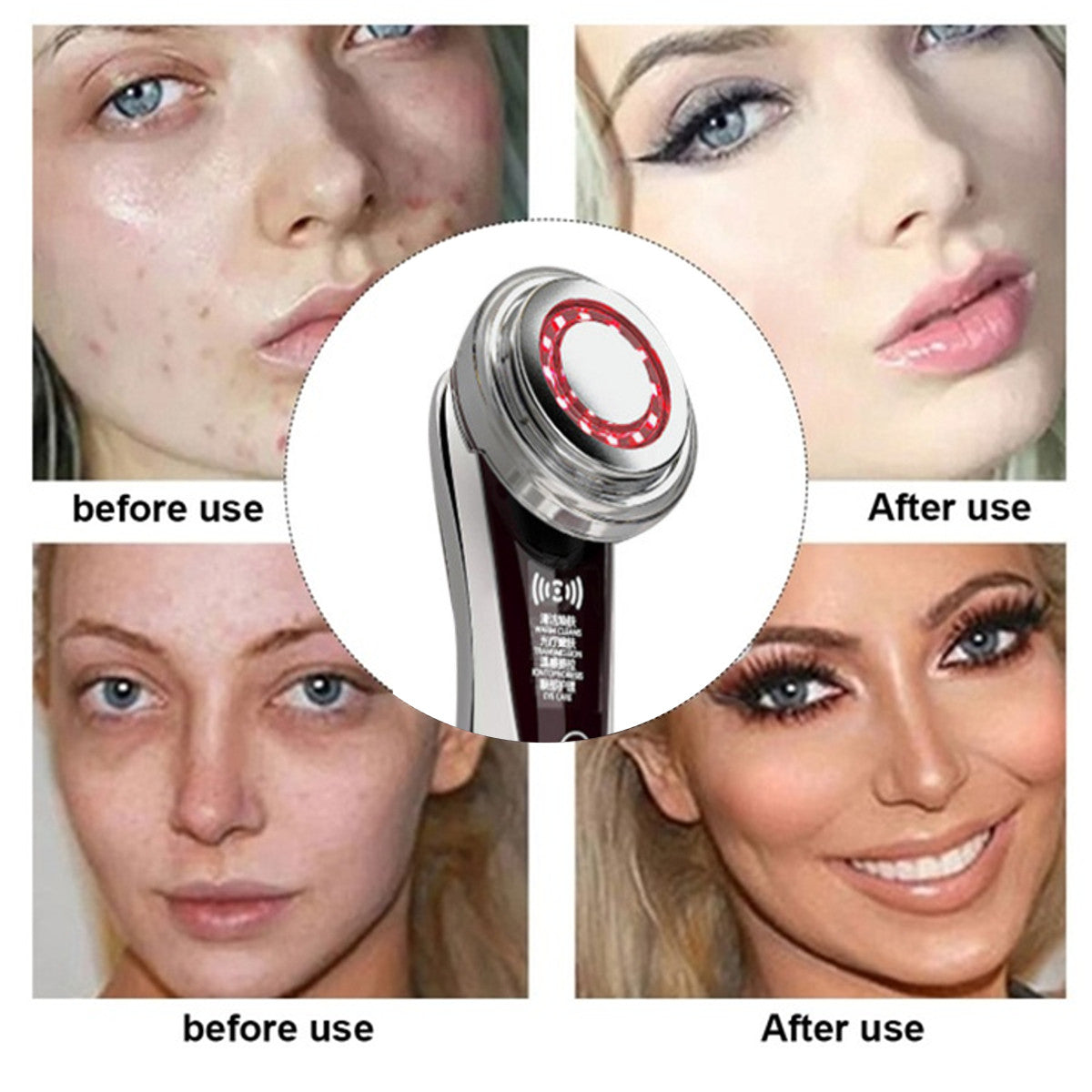 EMS Mesotherapy Facial Care Device – Electroporation Face Lifting & Firming Skin Tightening Beauty Instrument