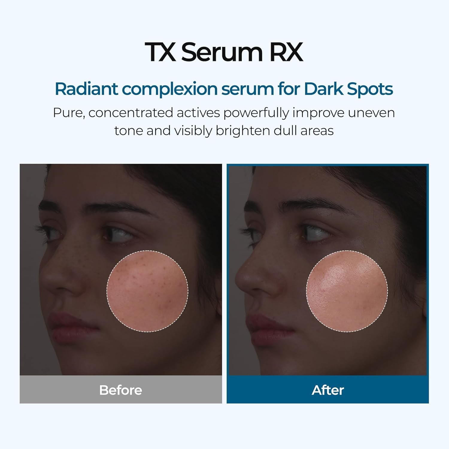 Dr.Melaxin TX-Ampoule Rx – 30ml | Advanced Brightening & Skin Repair Serum