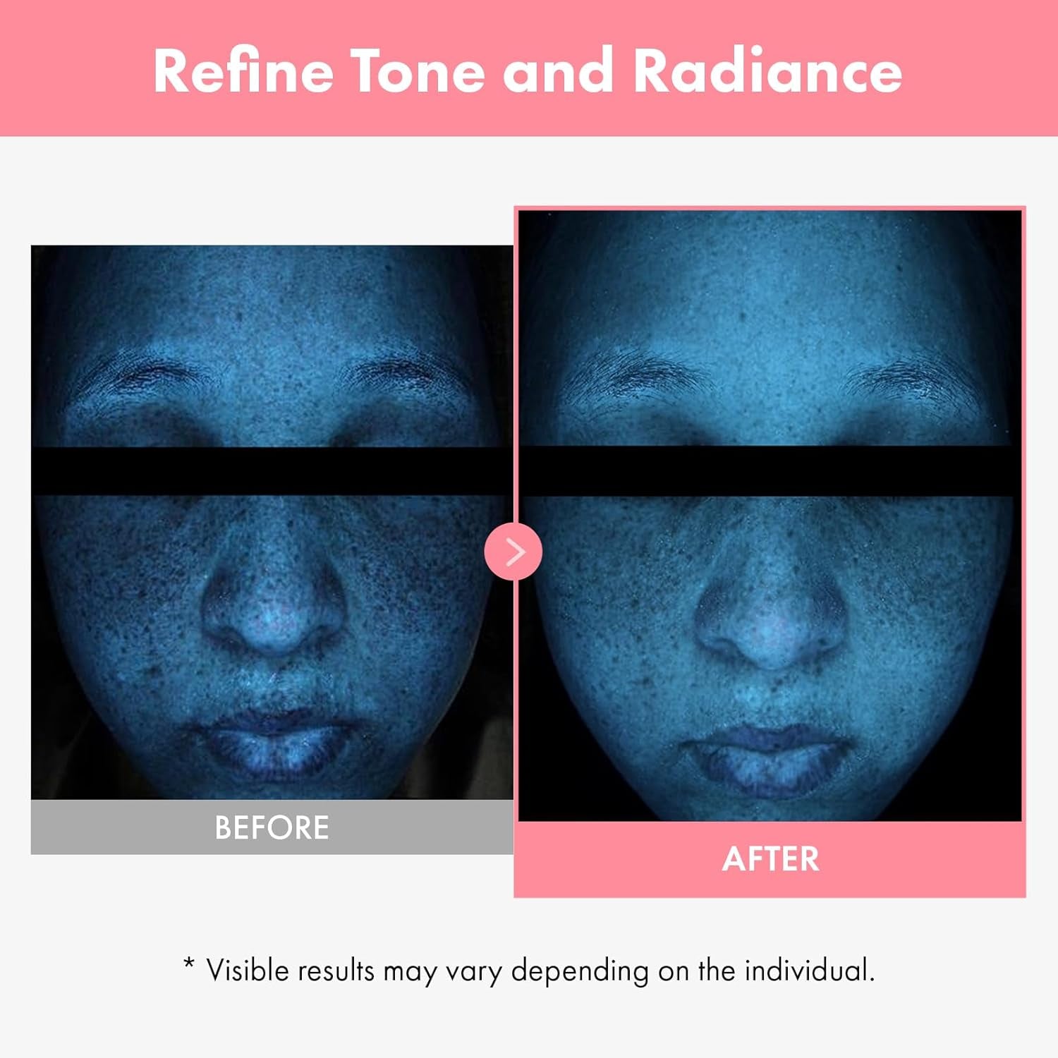 PDRN Hyaluron Face Cream, 5,000Ppm Salmon DNA, Niacinamide, Hyaluronic Acid and Panthenol Moisturizer for Hydrating & Firming, Uneven Skin Tone Care, Korean Skincare, 50Ml / 1.69 Fl. Oz.