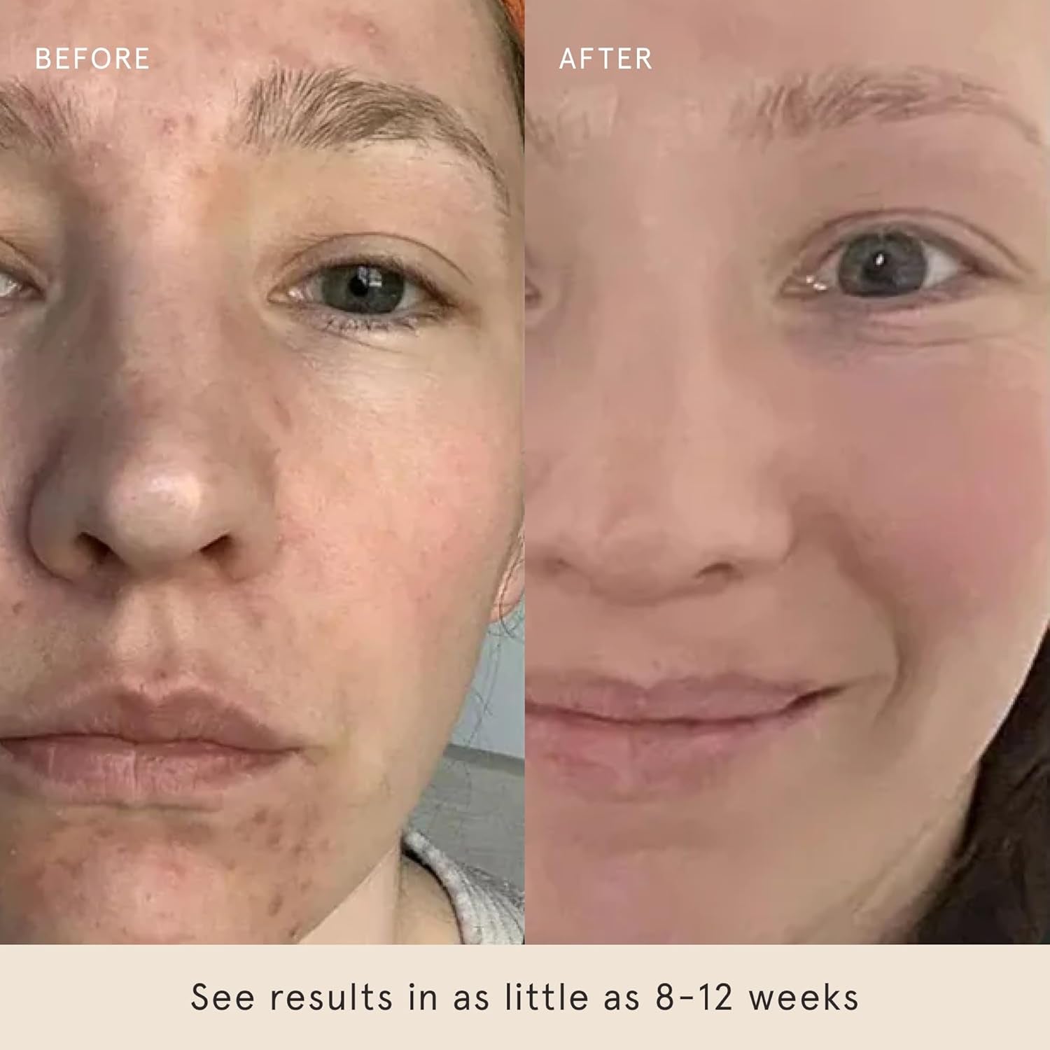 Glow Peel Pads (60 Count) - Deep Exfoliating Face & Body Pads with 15% Glycolic Acid, Squalane & Vitamin E - Smooths Texture, Reduces Breakouts & Fine Lines