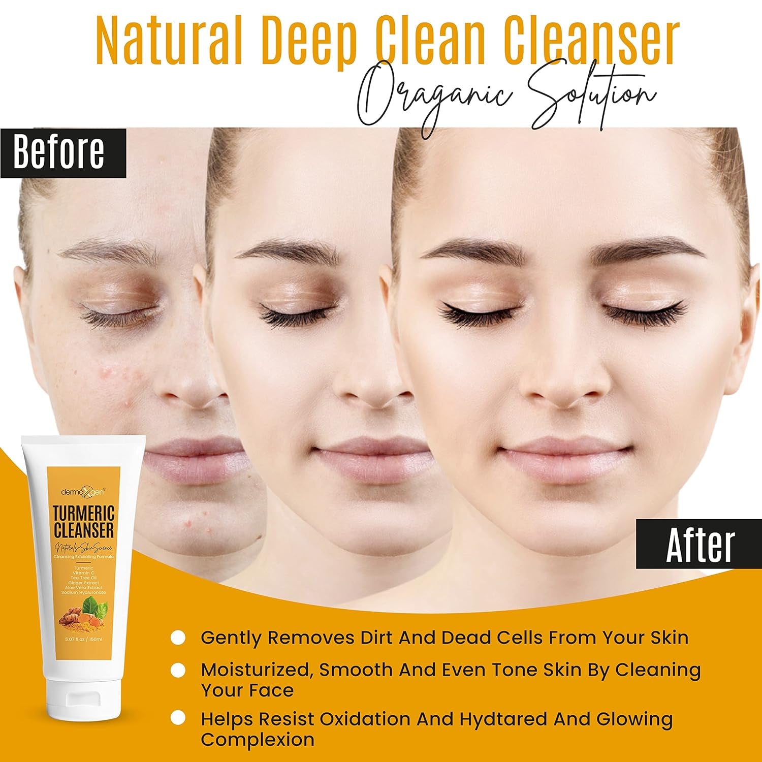 DERMAXGEN Turmeric Cleanser – 150ml | Brightening Face Wash for Acne, Dark Spots & Uneven Tone