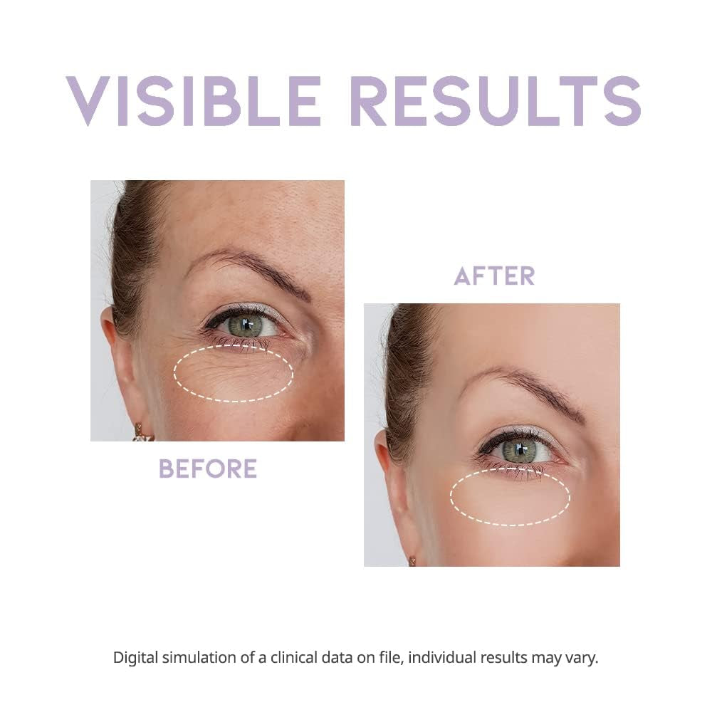 #OOTD P+ Overnight Eye Cream - 25g