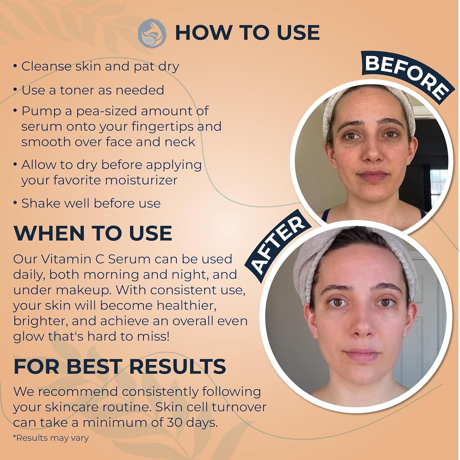Foxbrim Naturals Vitamin C Radiate Serum – 30ml | Brightening & Anti-Aging Face Serum