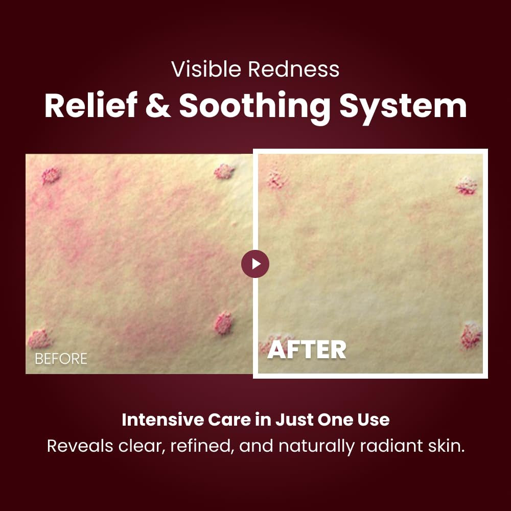 Curepair Melder SOS Cream [4Ever Edition] –Peptide Repair Night Cream for Radiance, Recovery & Post-Procedure Care | Advanced Skincare for Home Use | Dermatologist Co-Developed Formula