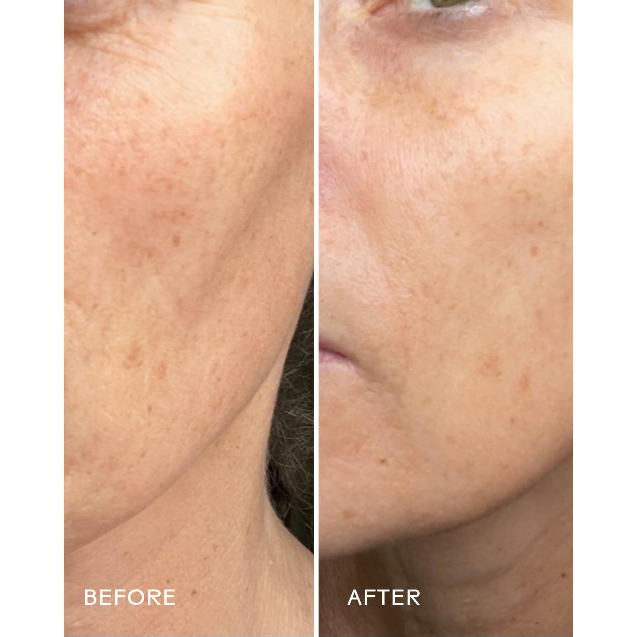 - Boost 49% Rosehip Oil Serum | Moisturize, Firm, Plump Skin | Cruelty-Free, Vegan, Paraben-Free, Sensitive Skin Safe (1 Fl Oz | 30 Ml)