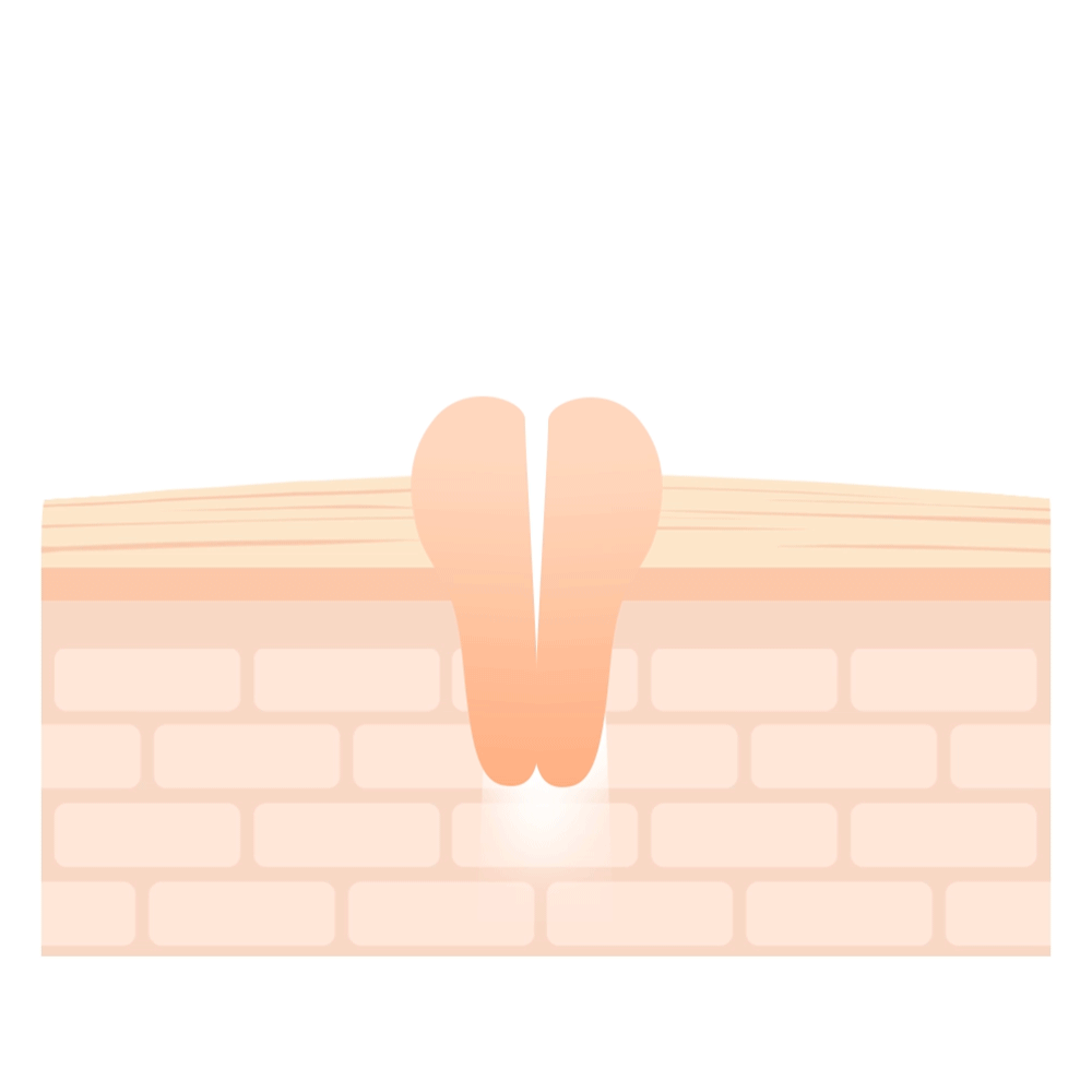 Needly Crossbarrier Mask 30 Sheets - Deep Hydration & Barrier Repair