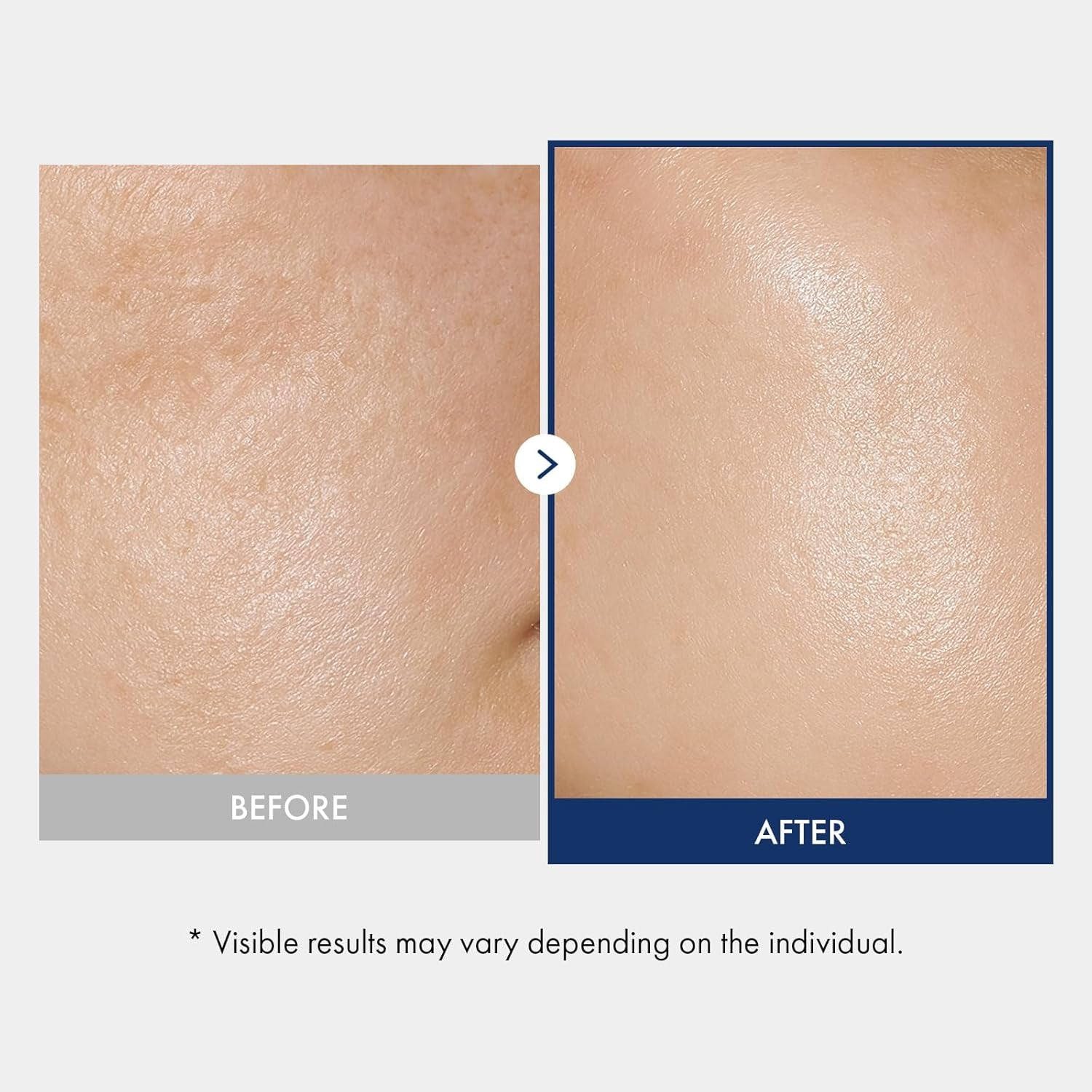 Ceramide Barrier Serum, Hydrating Serum for Face, 1,250Ppm Ceramide Complex, Niacinamide, Collagen, Panthenol, Centella, Glass Skin, Fragrance-Free, Korean Skin Care, 33 Ml / 1.11 Fl. Oz.