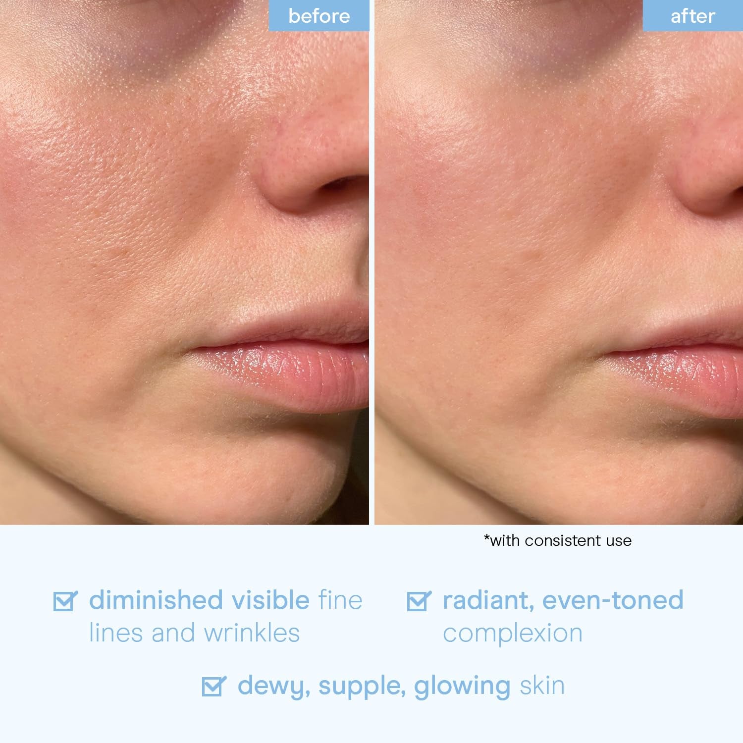 Baebody Snail Mucin Hydrating Serum – 100ml | Collagen-Infused K-Beauty Serum for Dewy Skin, Dark Spots & Fine Lines