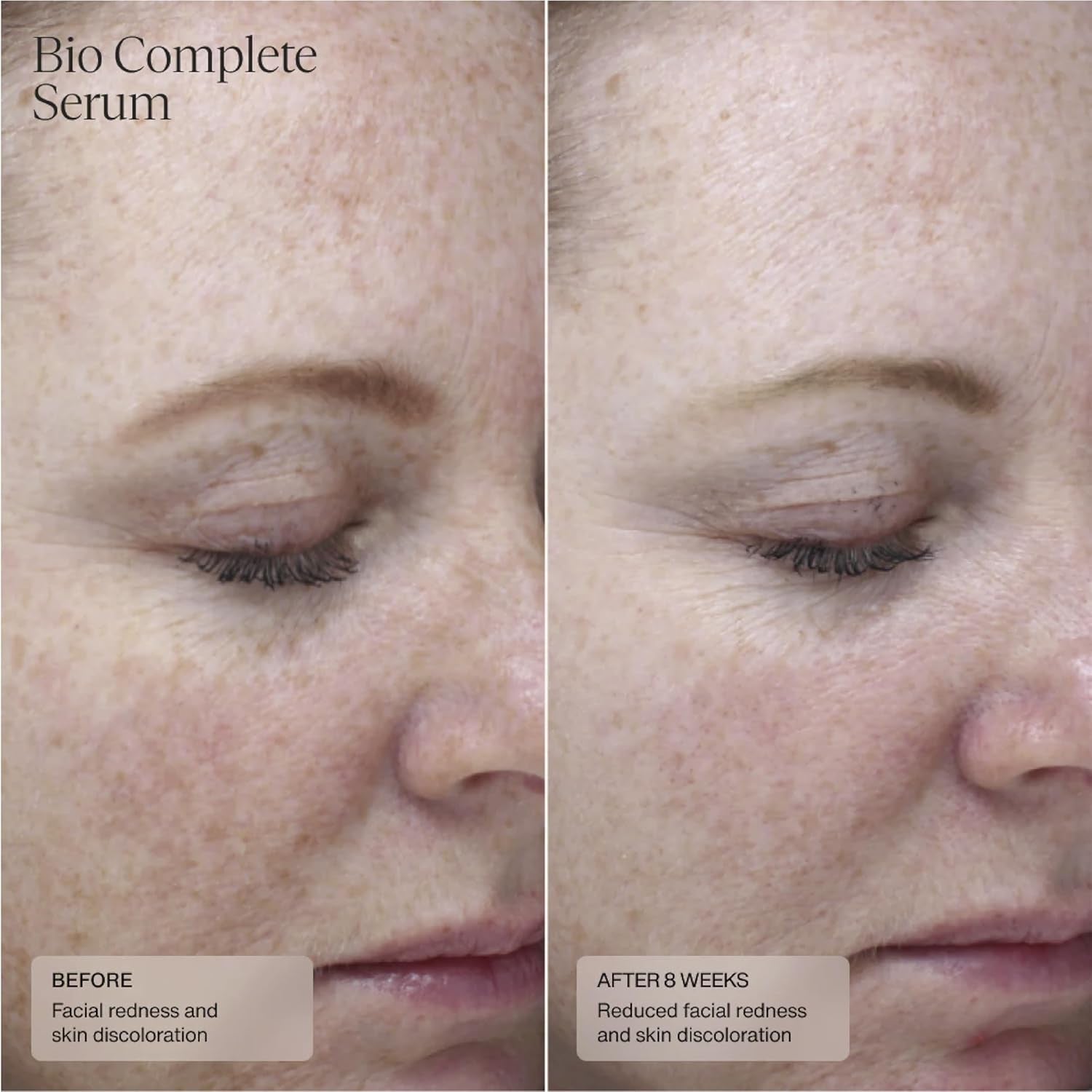 Senté Bio Complete Serum – 30ml | Gentle Retinoid for Fine Lines & Even Skin Tone