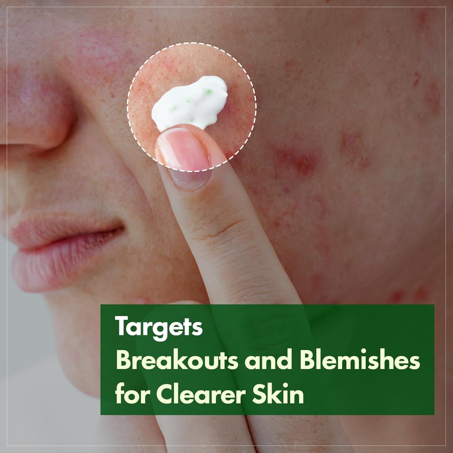 Madagascar Centella Cream, 706,580Ppm Madagascar Centella Asiatica, Moisturizer, Rapid Soothing, Deep Hydration with Cica Complex, Skin Barrier Repair, Irritation Relief, 50Ml / 1.69 Fl. Oz.