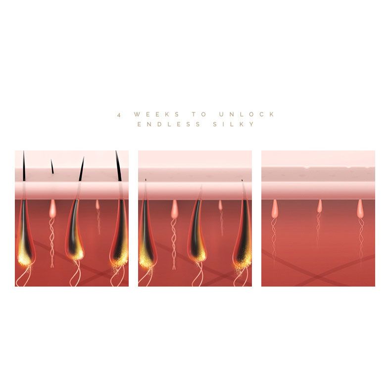 Full-Body IPL Laser Hair Removal Device – Home Rejuvenation for Men & Women