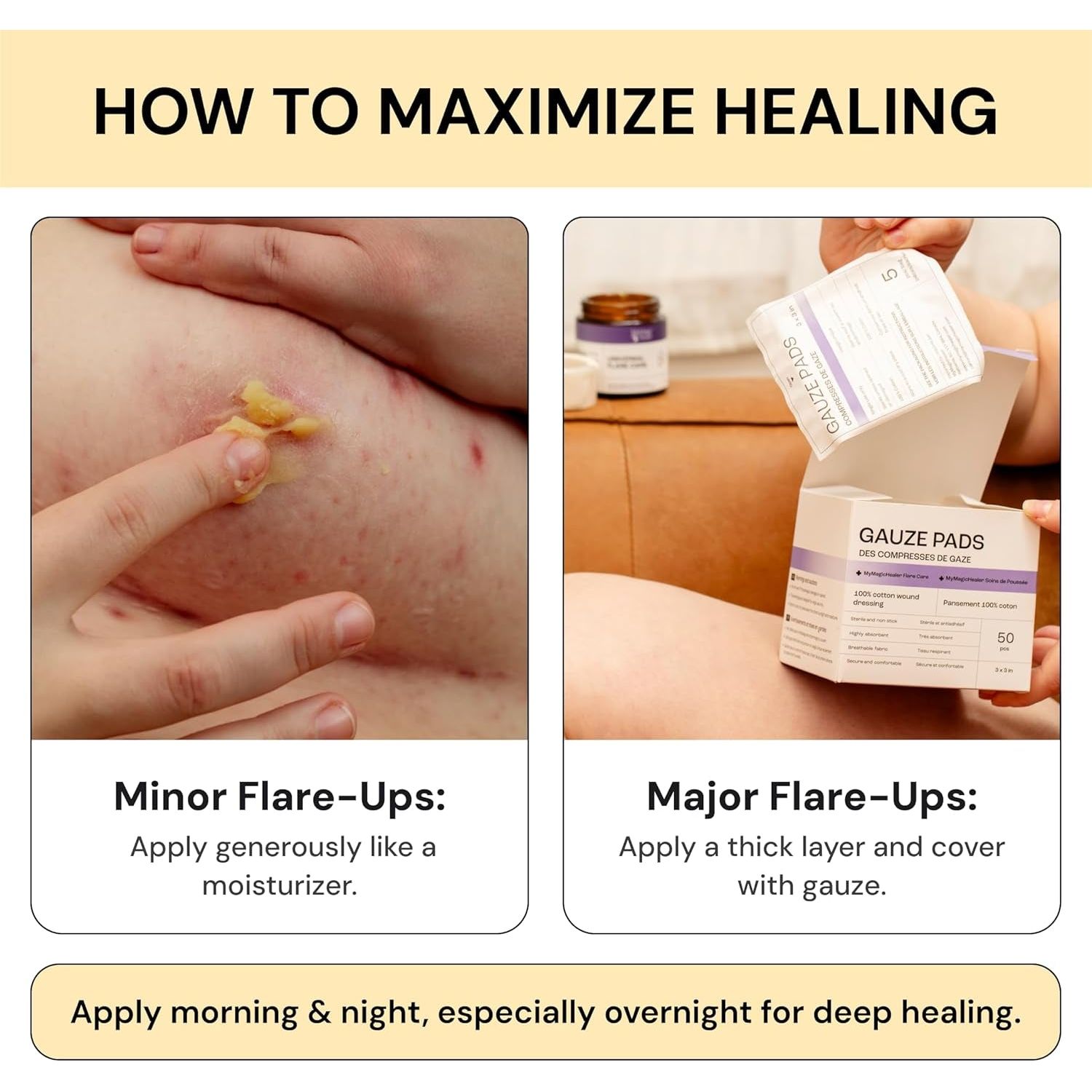 MyMagicHealer Universal Flare Care – 4oz (113g) | Natural Relief for HS, Boils, Abscesses & Skin Flare-Ups