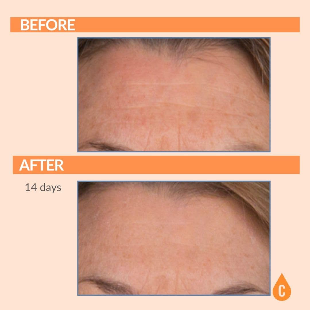 Serious Skincare Serious-C3 Plasma™ Bio Technology C Serum – 30ml | Brightening, Hydrating & Anti-Aging Treatment