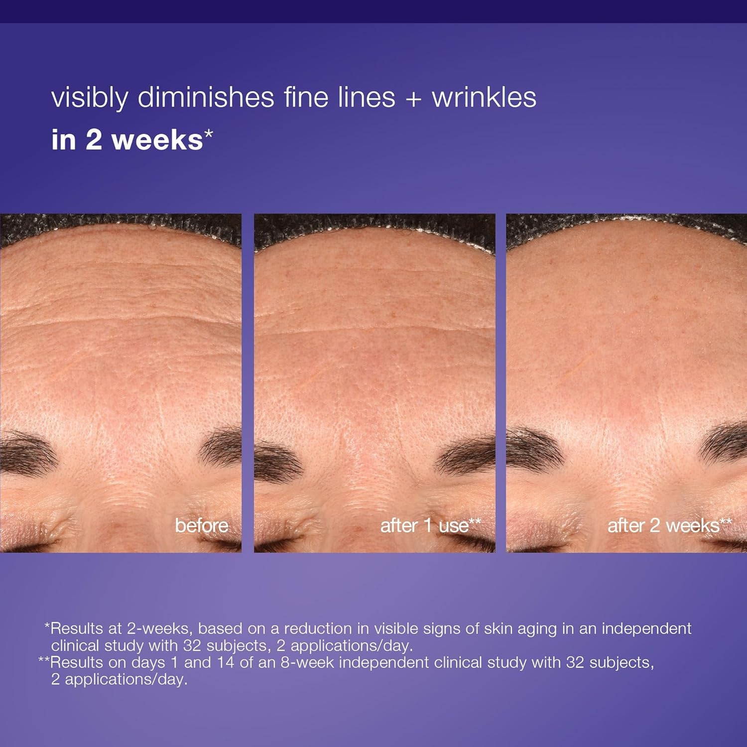 Phyto Nature E2, Daily Leave on Face Exfoliant for Skin Renewal, Exosome Pre Serum, 3.4 Fl Oz