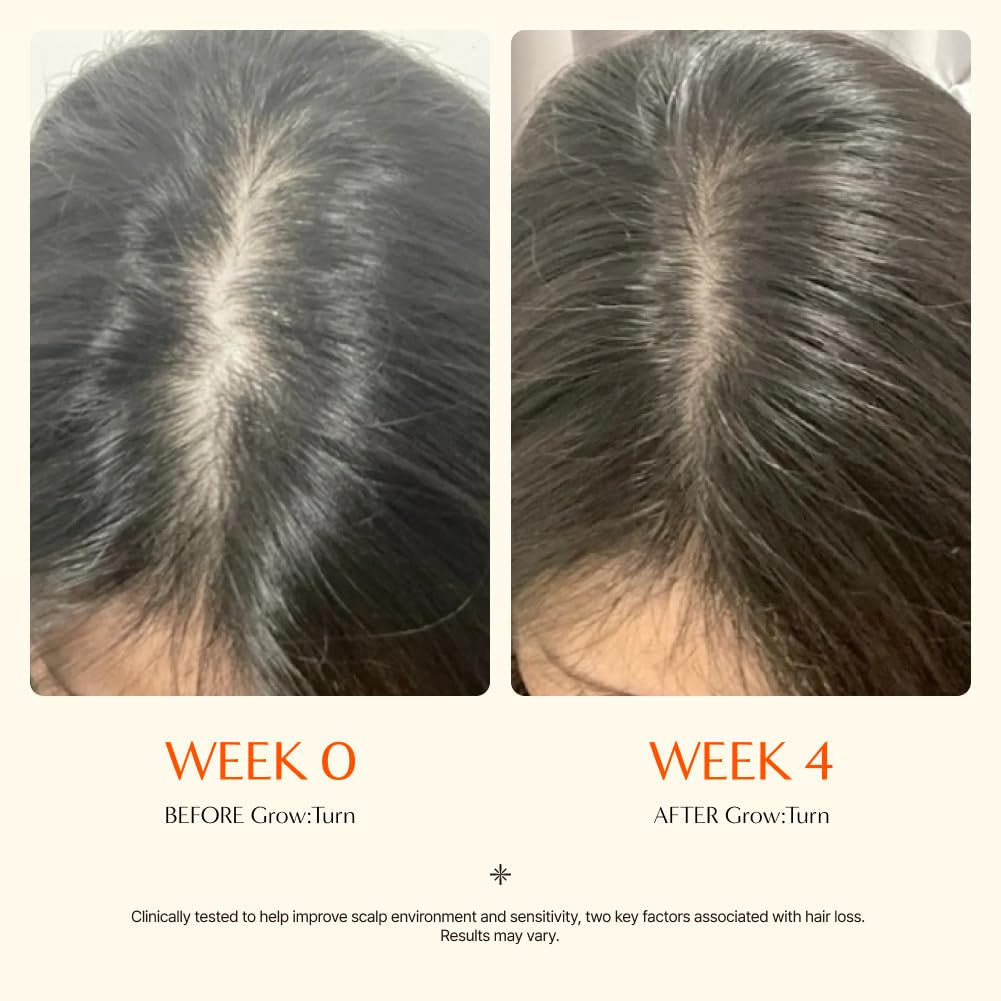 Lilyeve Growturn Hair Growth Serum with Built in Brush for Hair Growth & Thickening | Treatment for Thinning Hair, Hair Loss | Low Irritation, Fragrance-Free, Sulfate & Paraben-Free, 3.38 Fl. Oz. (Pack of 1)