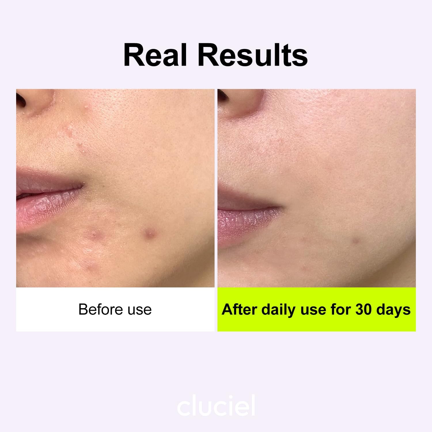 Cluciel Niacinamide Peptide Serum – 50ml | Radiant Glow, Even Tone & Pore Refinement