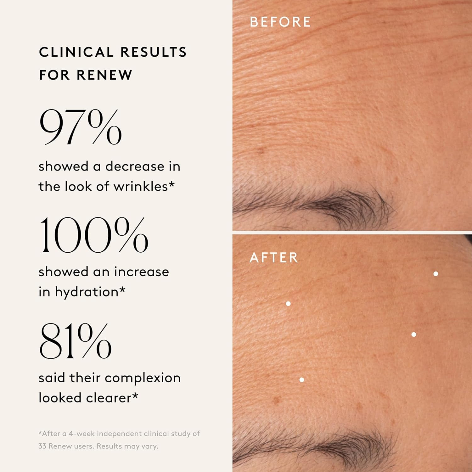 the Night Set | Renew Resurfacing Night Serum (30 Ml) + Rejuvenate Restorative Face Oil (35 Ml) with Hyaluronic Acid, Argan & Sea Buckthorn Oils and Fruit Ahas (Set of 2)