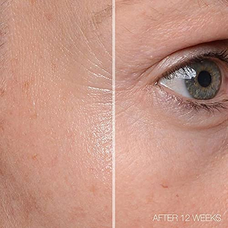 MD Complete by Dr. Brian Zelickson Total Eye Treatment – 15ml | Brightening & Firming Eye Care