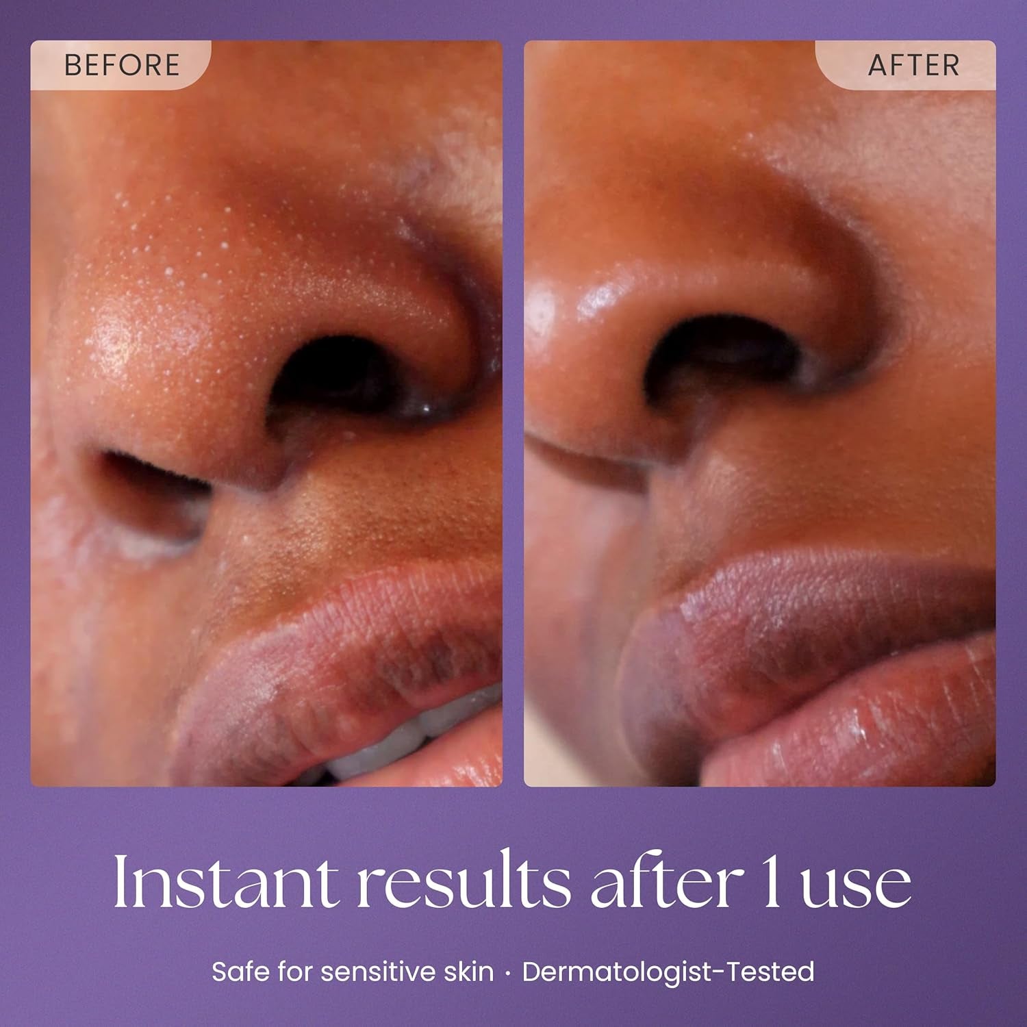Prakti PritiPolish Instant Glow Exfoliator – 30ml | Radiant Skin, Instantly Smooth & Brighten