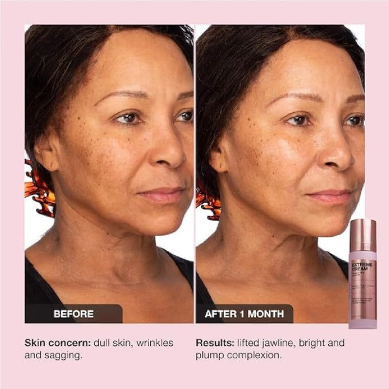 iNNBEAUTY PROJECT Extreme Cream Firming & Lifting Moisturizer – 50ml | Advanced Anti-Aging, Refillable Glow