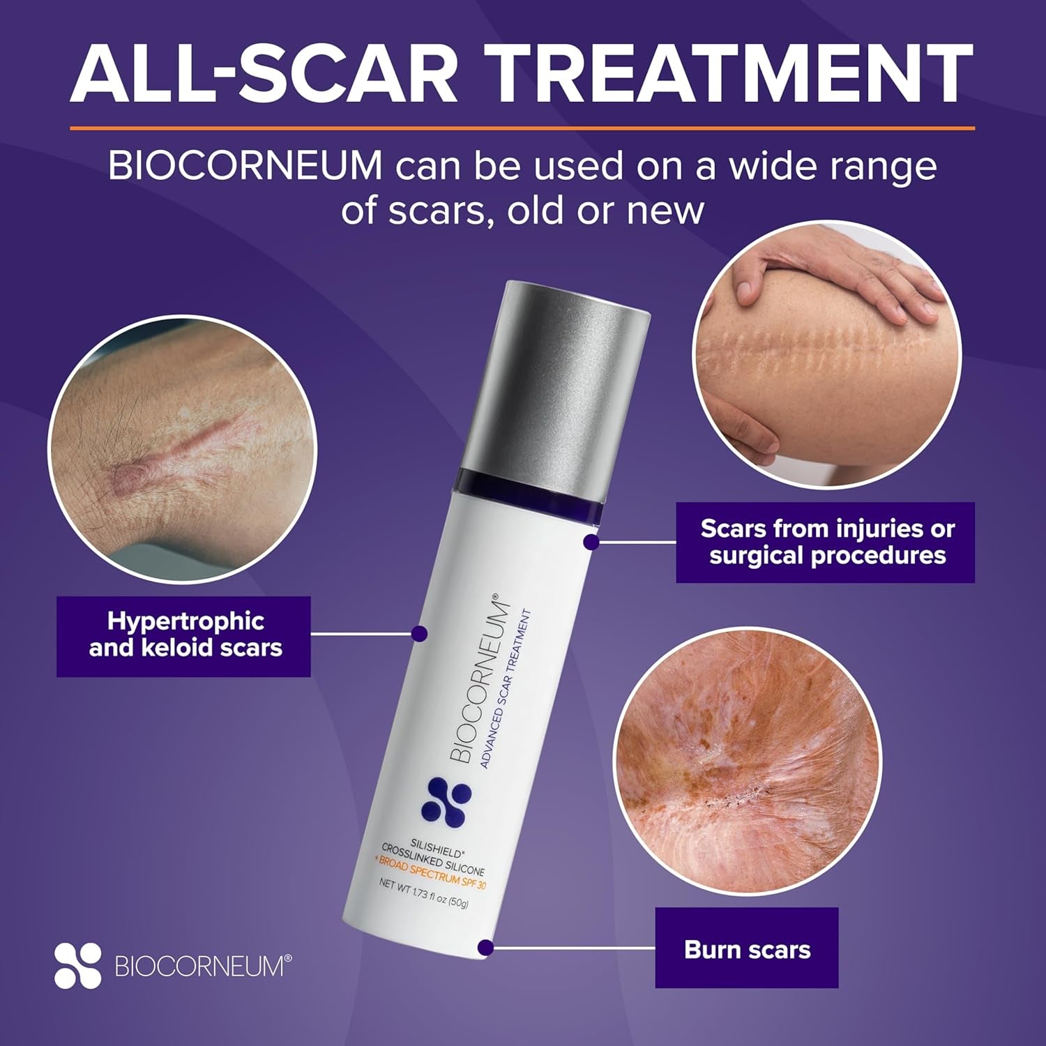 BIOCORNEUM Advanced Scar Treatment - 20g