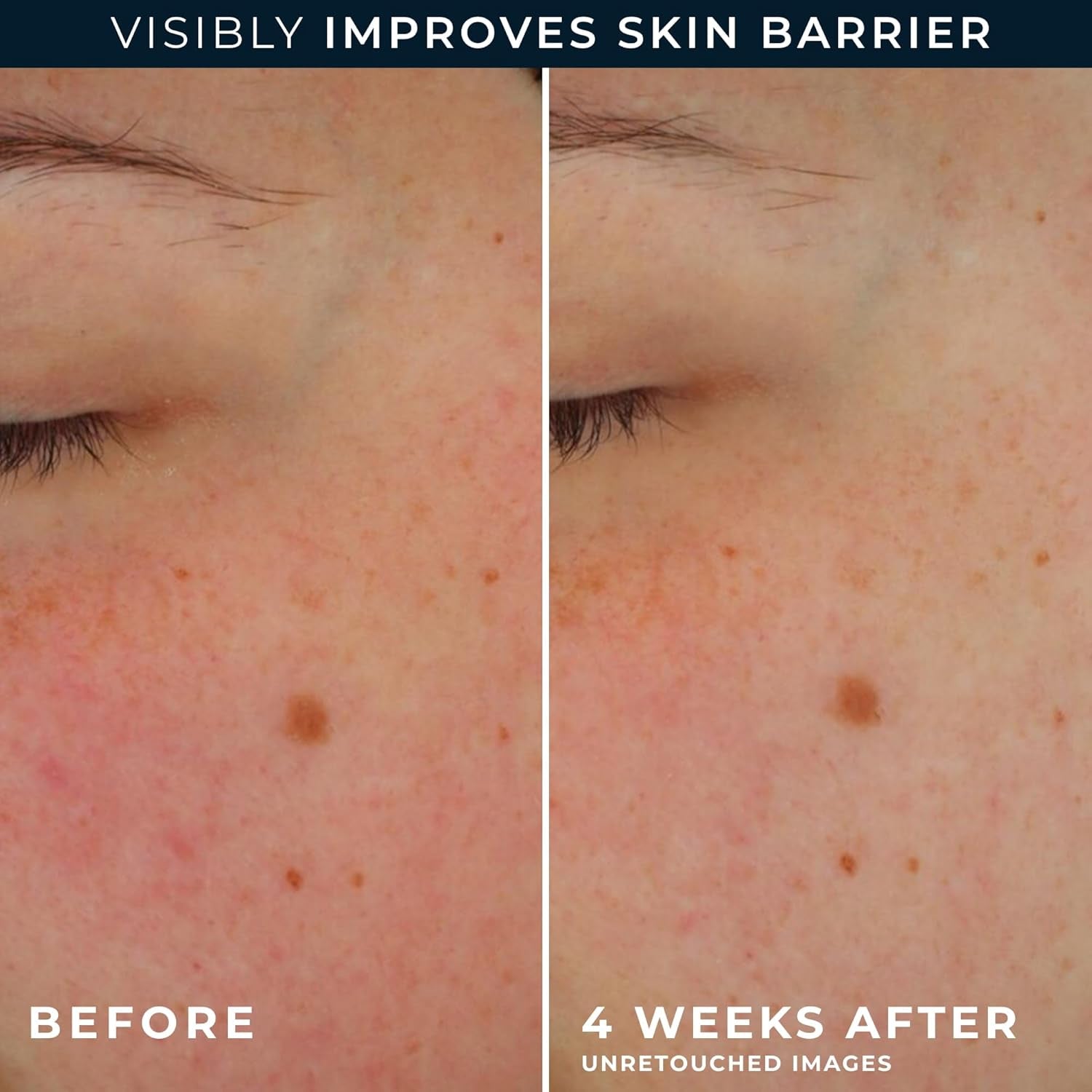 RoC Barrier Renew AM SPF 30 Moisturizer (74ml) with Retinol Correction Line Smoothing Eye Cream Packette (2ml)