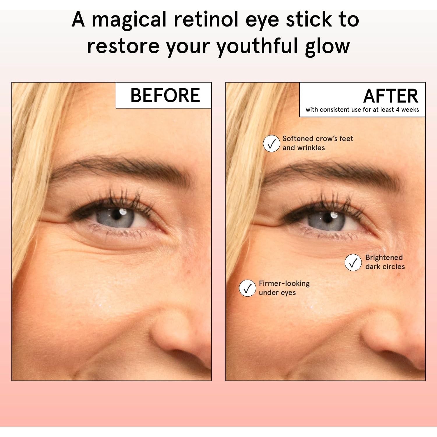grace & stella Restoring Eye Balm (Retinol & Caffeine) – 3.5g | Brighten, De-Puff & Smooth Fine Lines On-the-Go