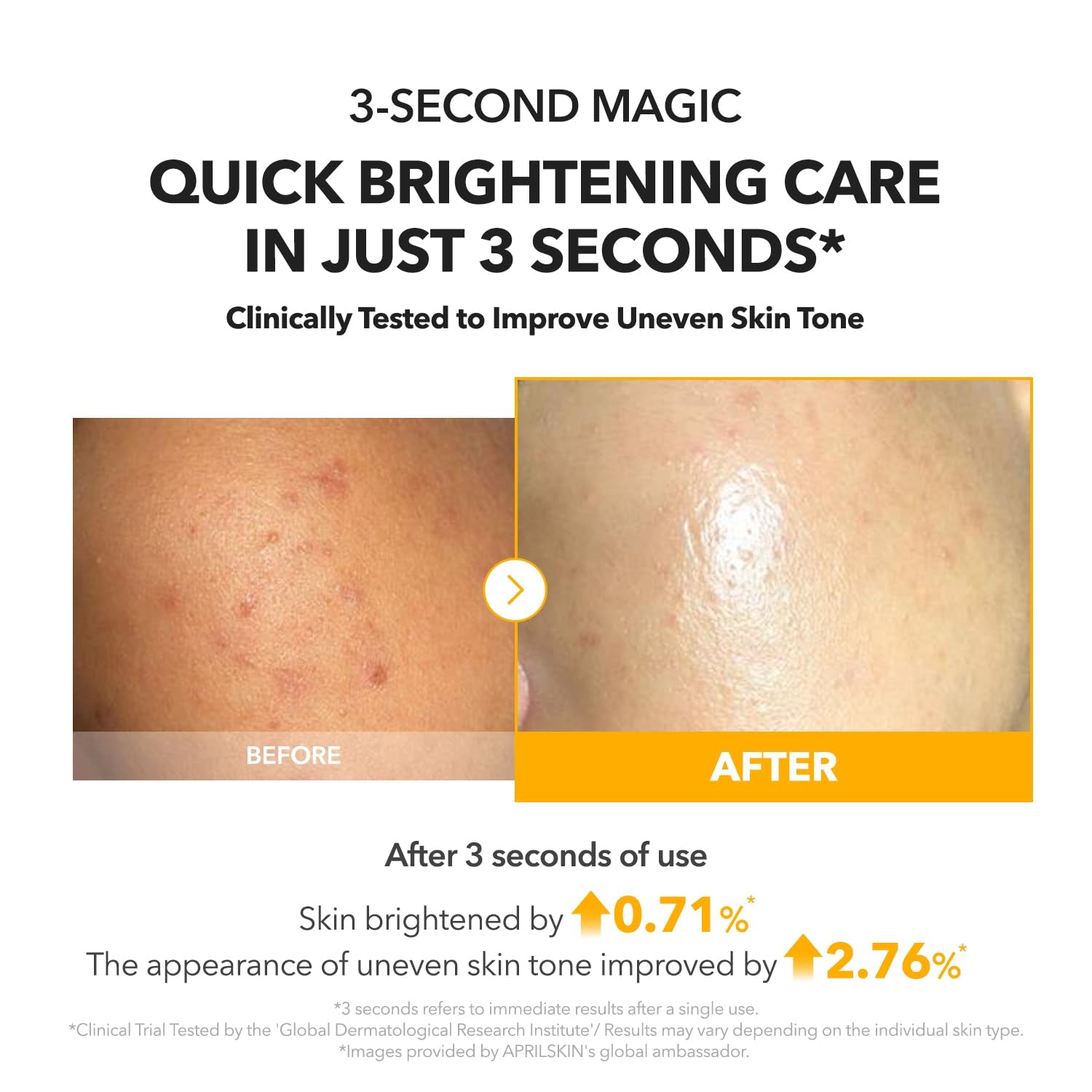 A.C.E Serum｜Vita Kojic Serum for Brightening & Glow｜3-Second Brightening｜Kojic Acid & Vitamin C for Uneven Skin Tone｜Korean Skin Care｜3.88 Oz.