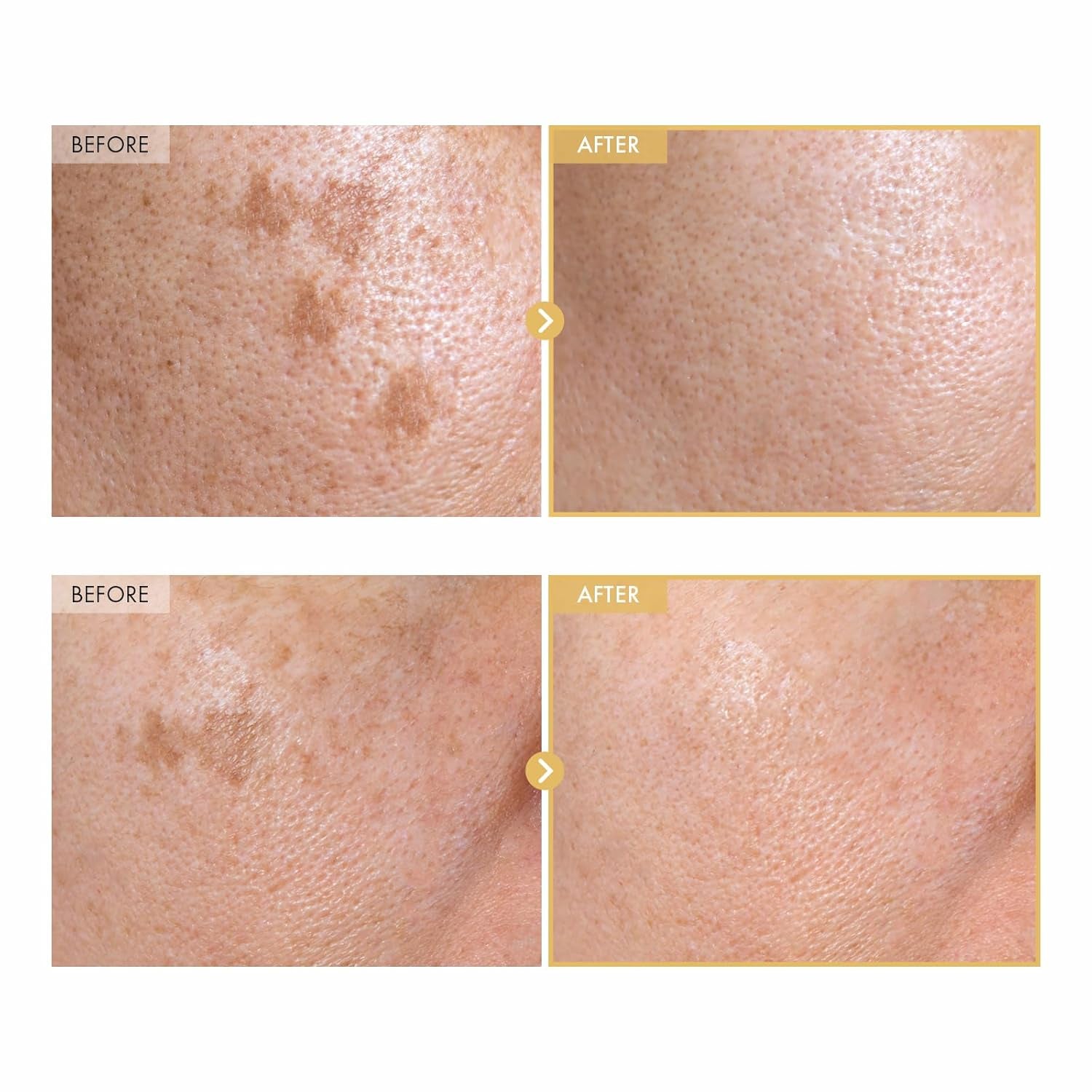 Black Snail Ginseng Serum, Ginseng 640,430Ppm, Snail Mucin, Hydrating Facial Moisturizer, Acne Scar Remover, Self Care, Glow Skin under Makeup, Korean Skin Care, 30Ml, 1.01 Fl. Oz.