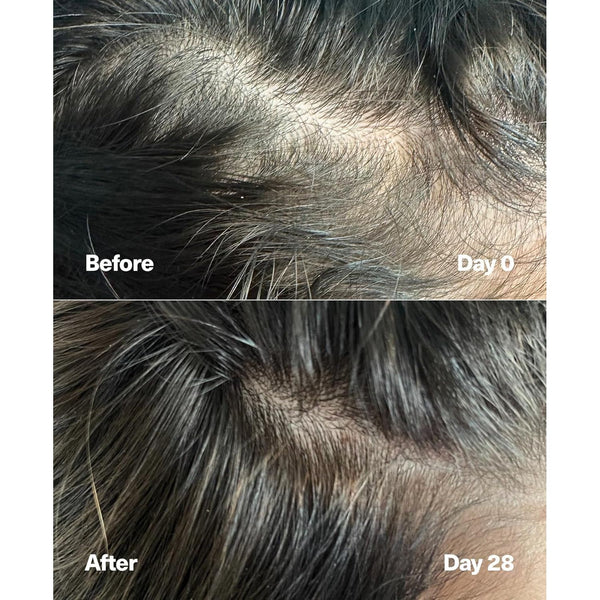 SickScience Powercycle Exosome Scalp Serum – 60ml | Hair Density, Regrowth & Thicker-Looking Hair