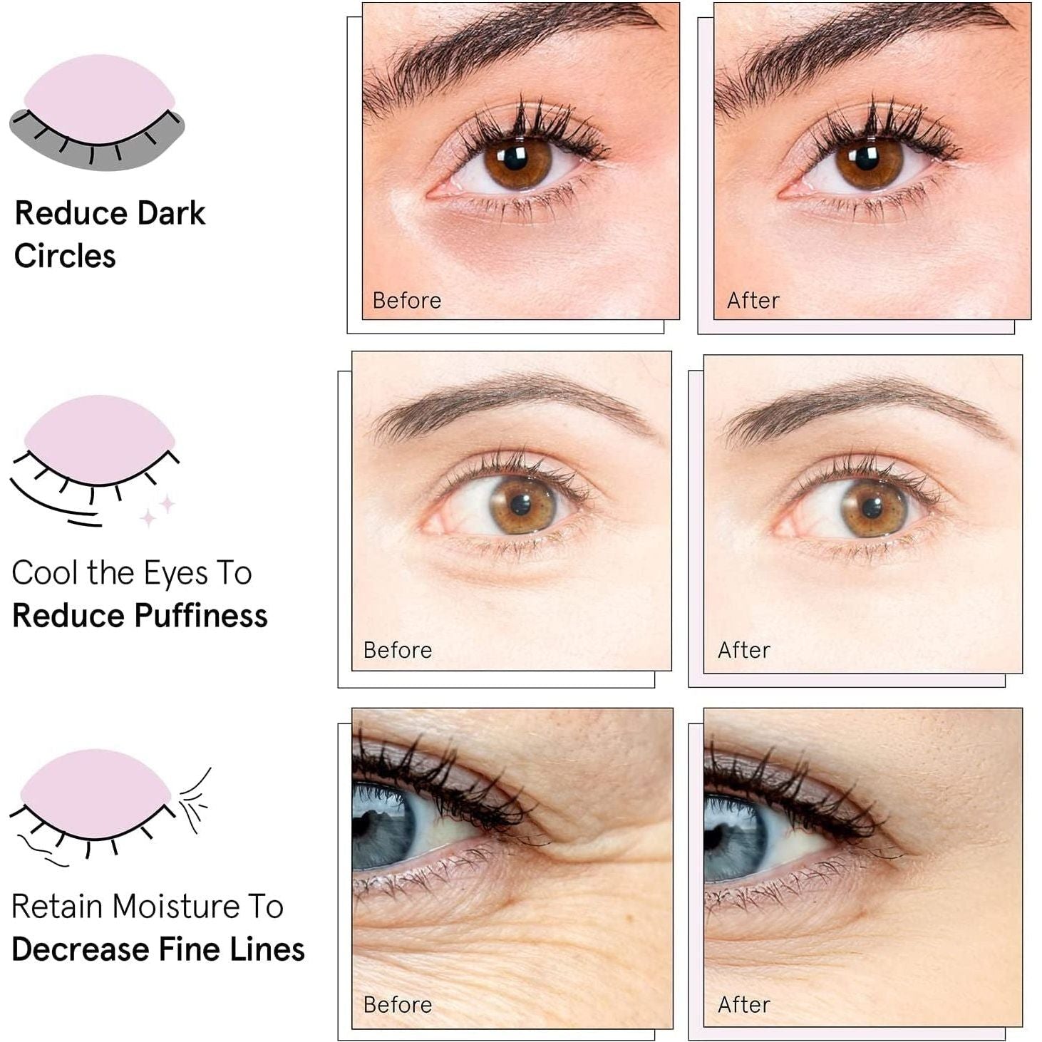 Under Eye Mask - Reduce Dark Circles, Puffy Eyes, Undereye Bags, Wrinkles - Gel under Eye Patches, Vegan Cruelty-Free Self Care by Grace and Stella (72 Pairs, Goldpinkblue)