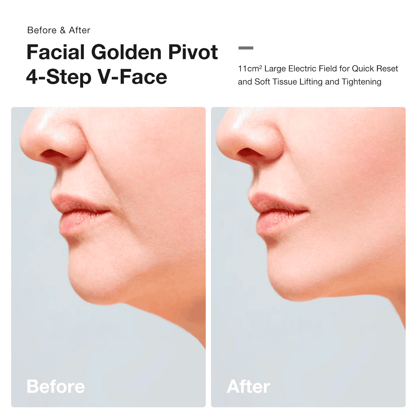 JOVS Slimax Microcurrent Full-Body Device – Lift and Tighten Skin