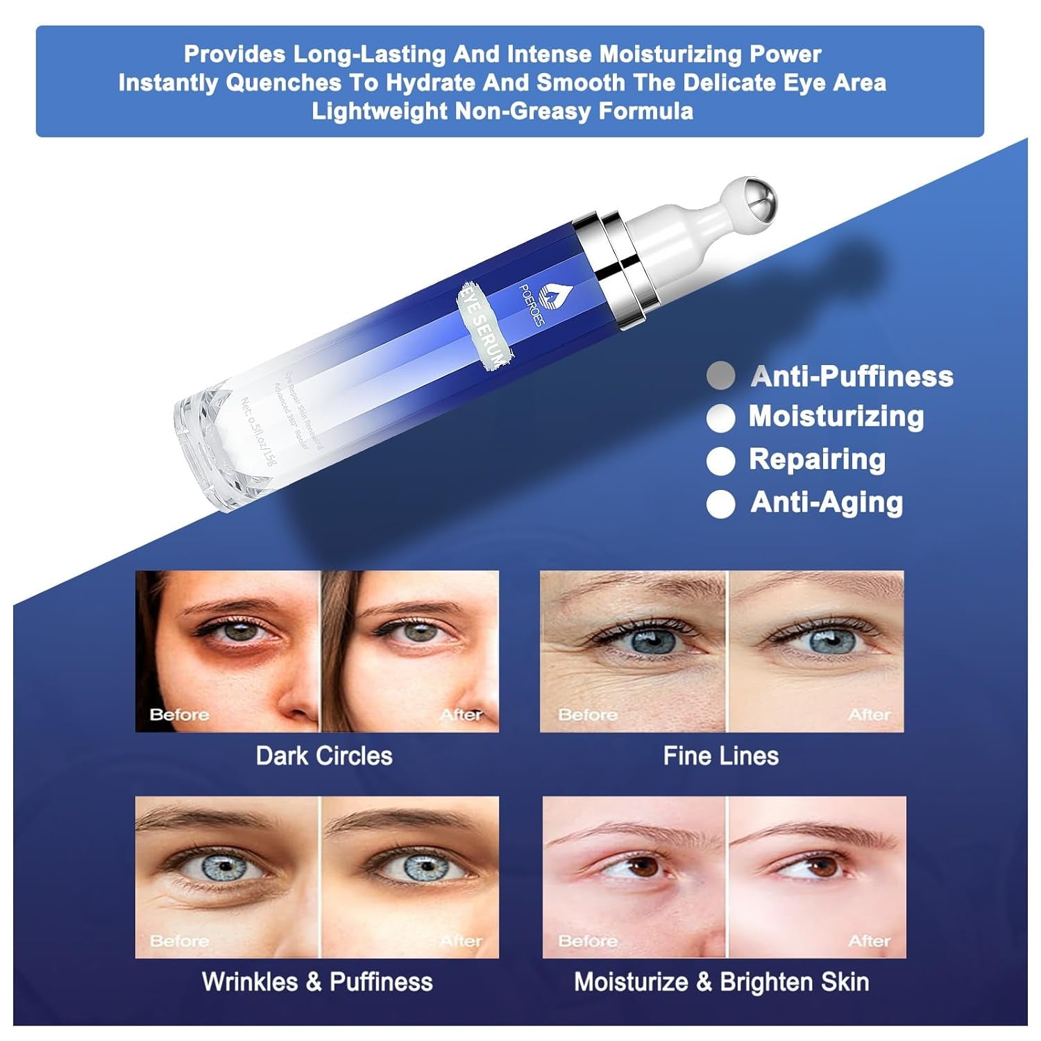POEROES Eye Serum – 15ml | 8% Caffeine + 8% Retinol Eye Roller for Dark Circles, Puffiness & Fine Lines