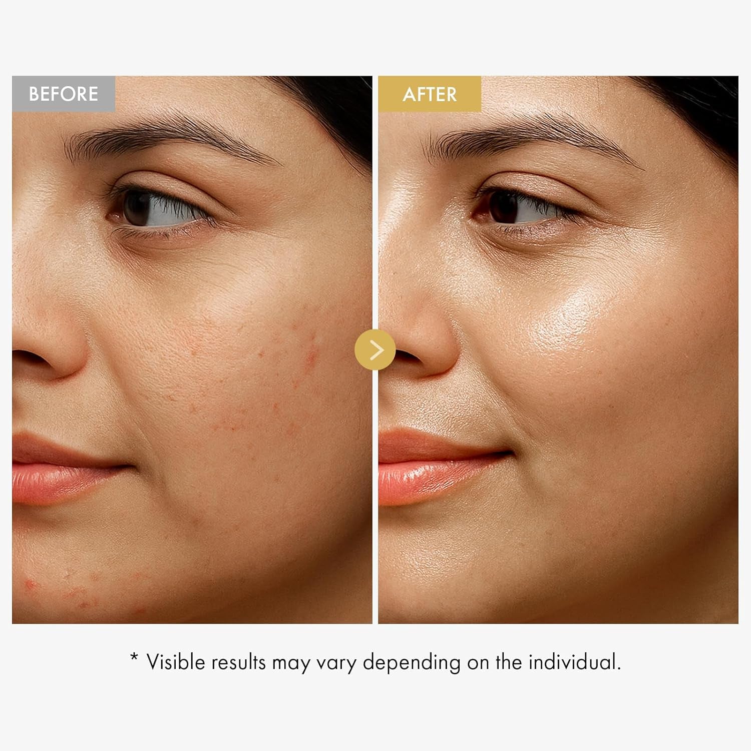 Glow Bean Face Cream, 63,844Ppm Soybean Ferment Extract, Korean Skincare for Glass Skin, Moisturizer, Relief, Smooth, Nourished Skin, Anti-Aging, Hydrating, K Beauty, 50 Ml / 1.69 Fl. Oz.