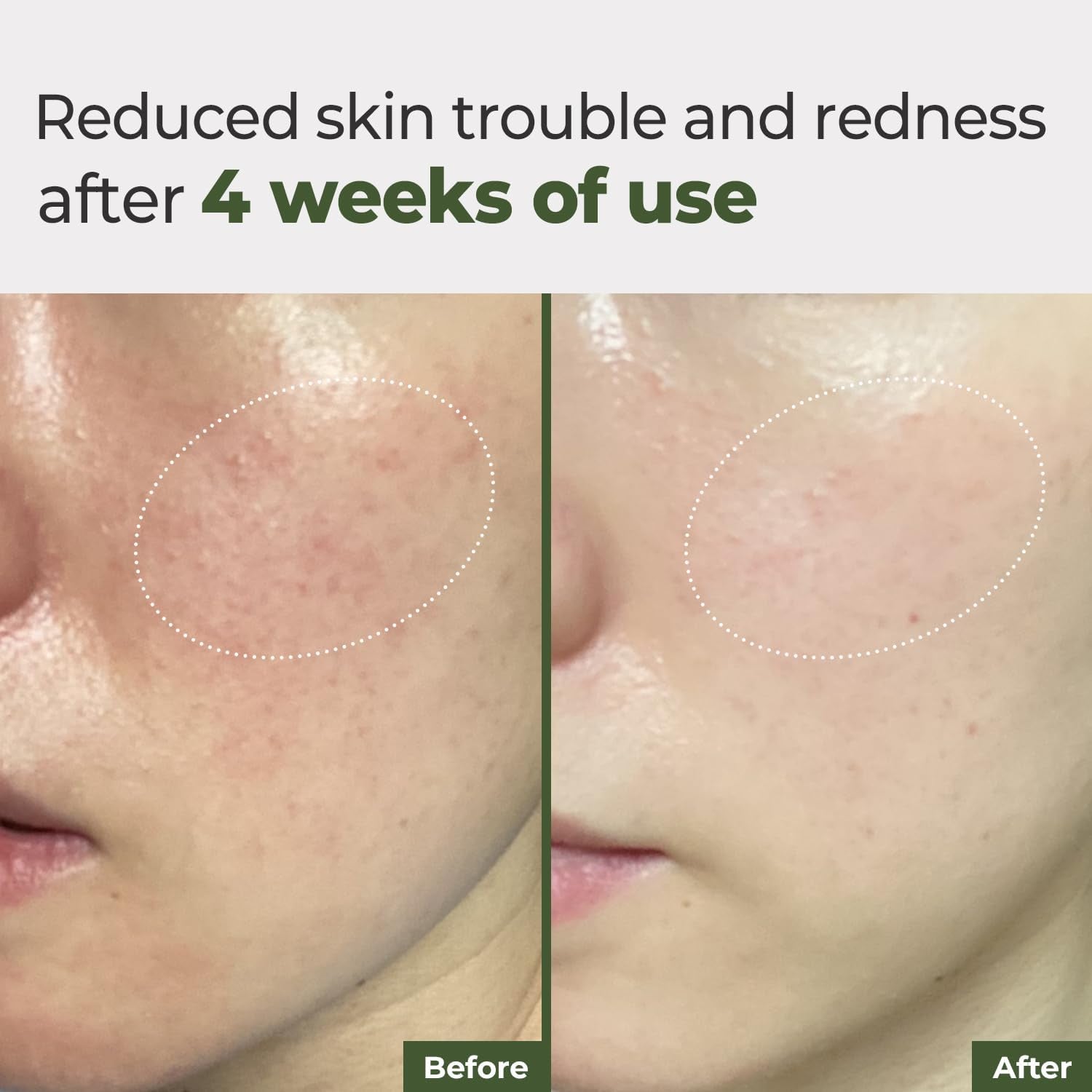 Rbfy. Daily Ampoule Pad – 170ml, 100 Pads