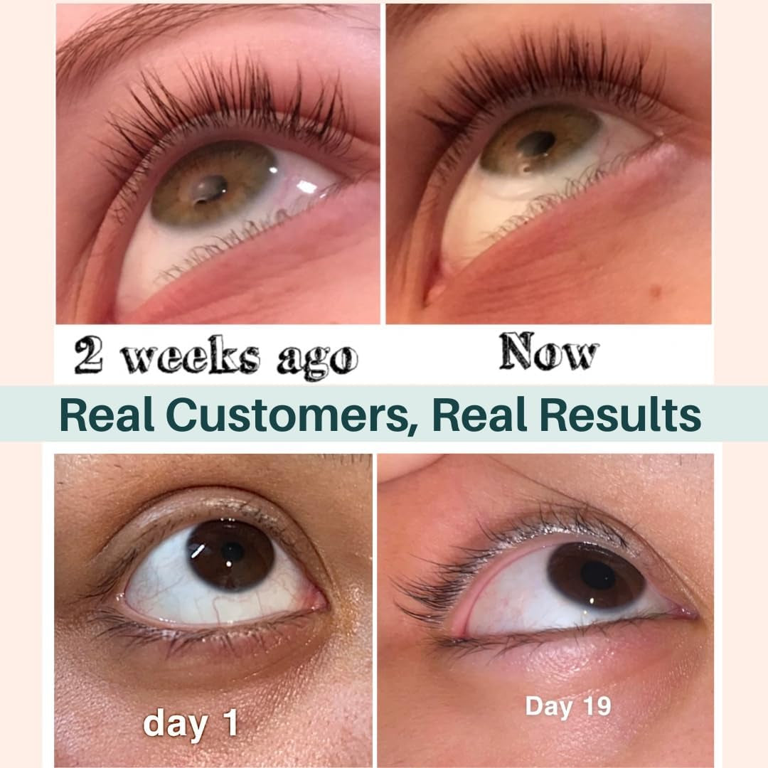 Live Fraiche Organic Cold Pressed Castor Oil Eyelash & Eyebrow Growth Treatment – 10ml | 100% Natural Growth Serum