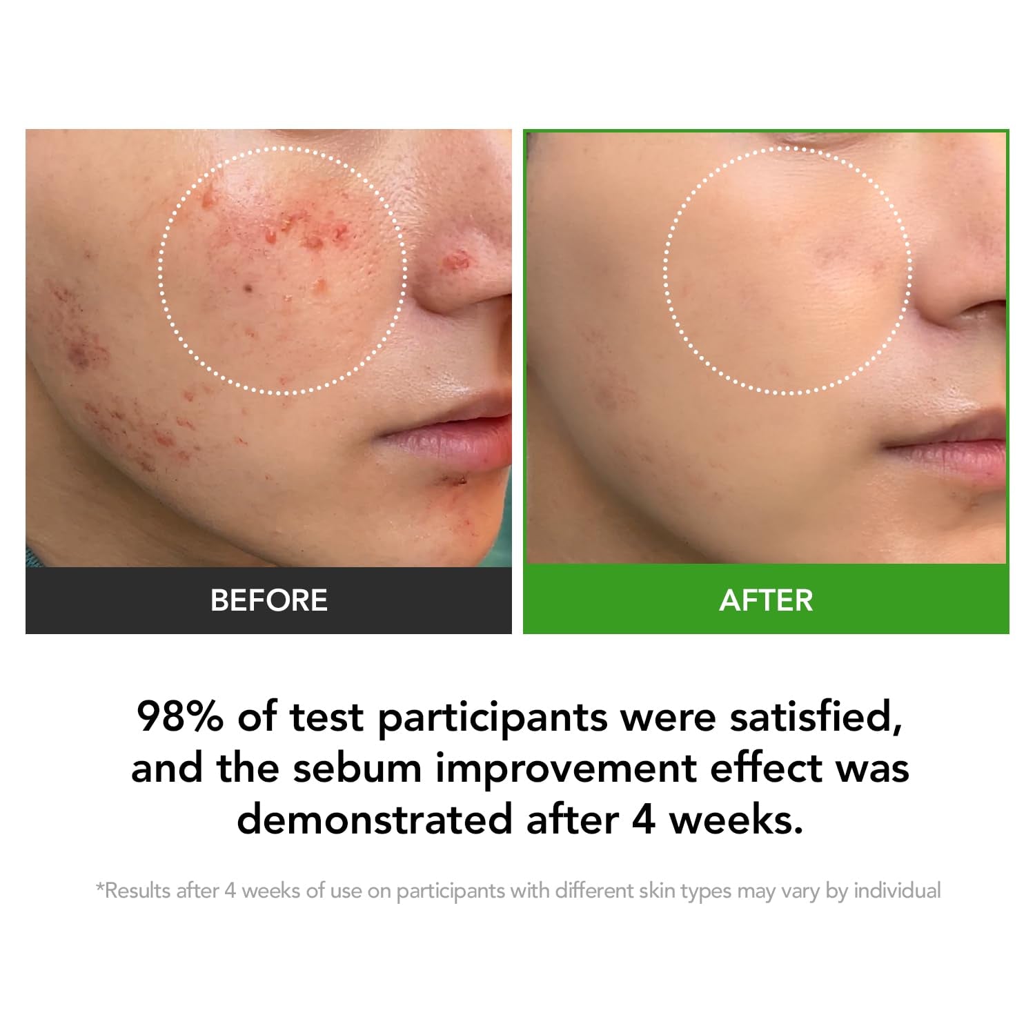 KIOSKIN  D-Panthenol 15.5 Cream - 35ml