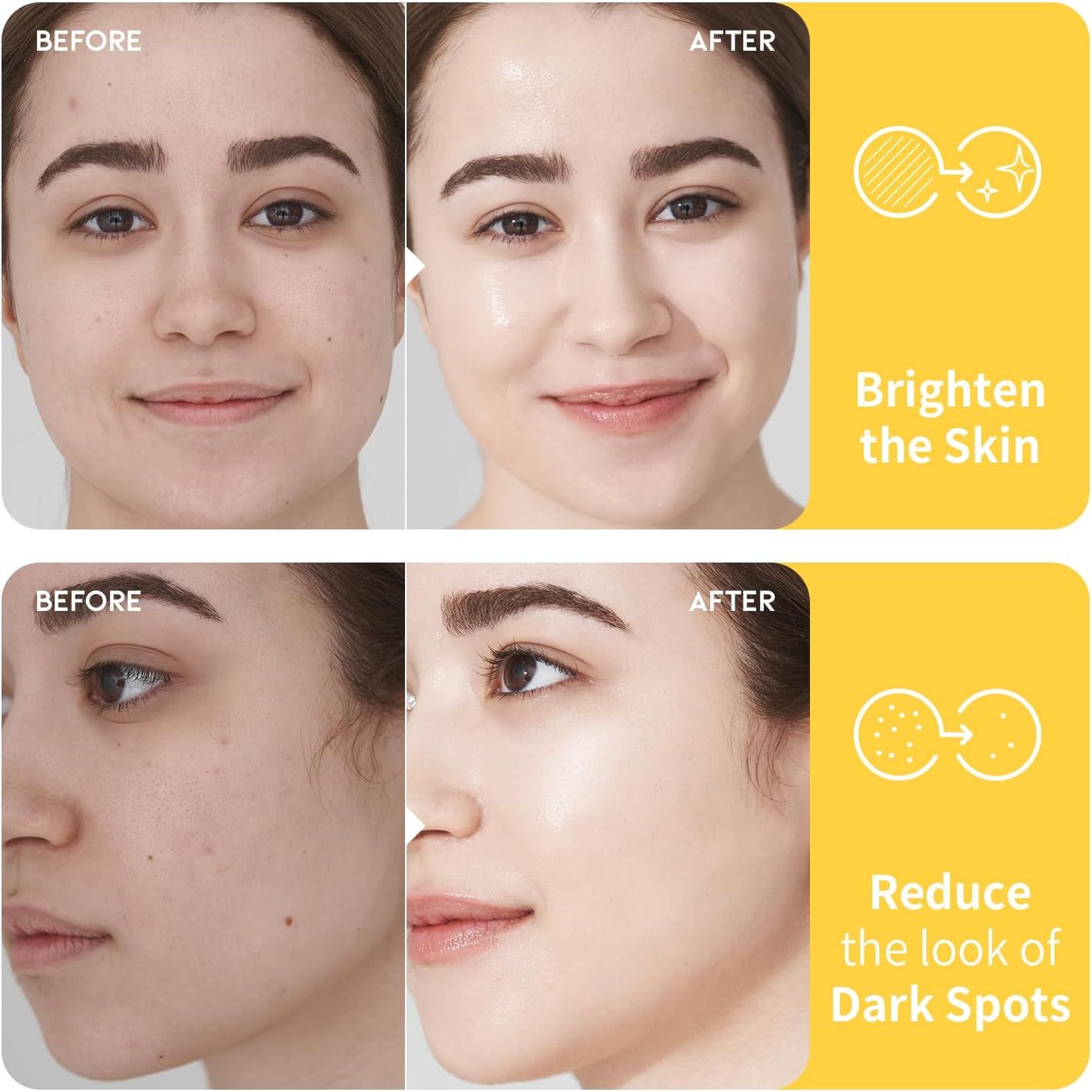 #OOTD VC+ Dark Spot Vitamin C Toner - 250ml