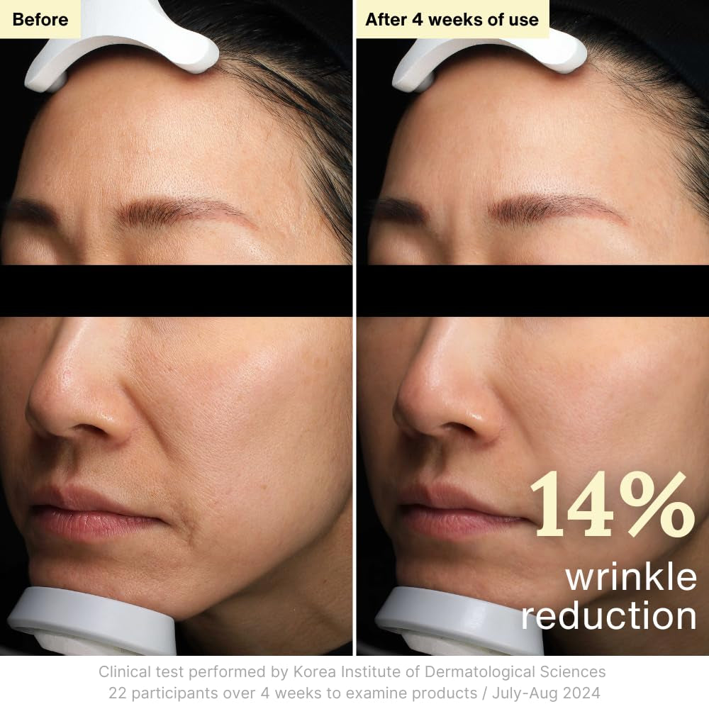 Rothea Resilience Cream – 50ml | Clinically Proven Wrinkle Reduction & 72-Hour Hydration